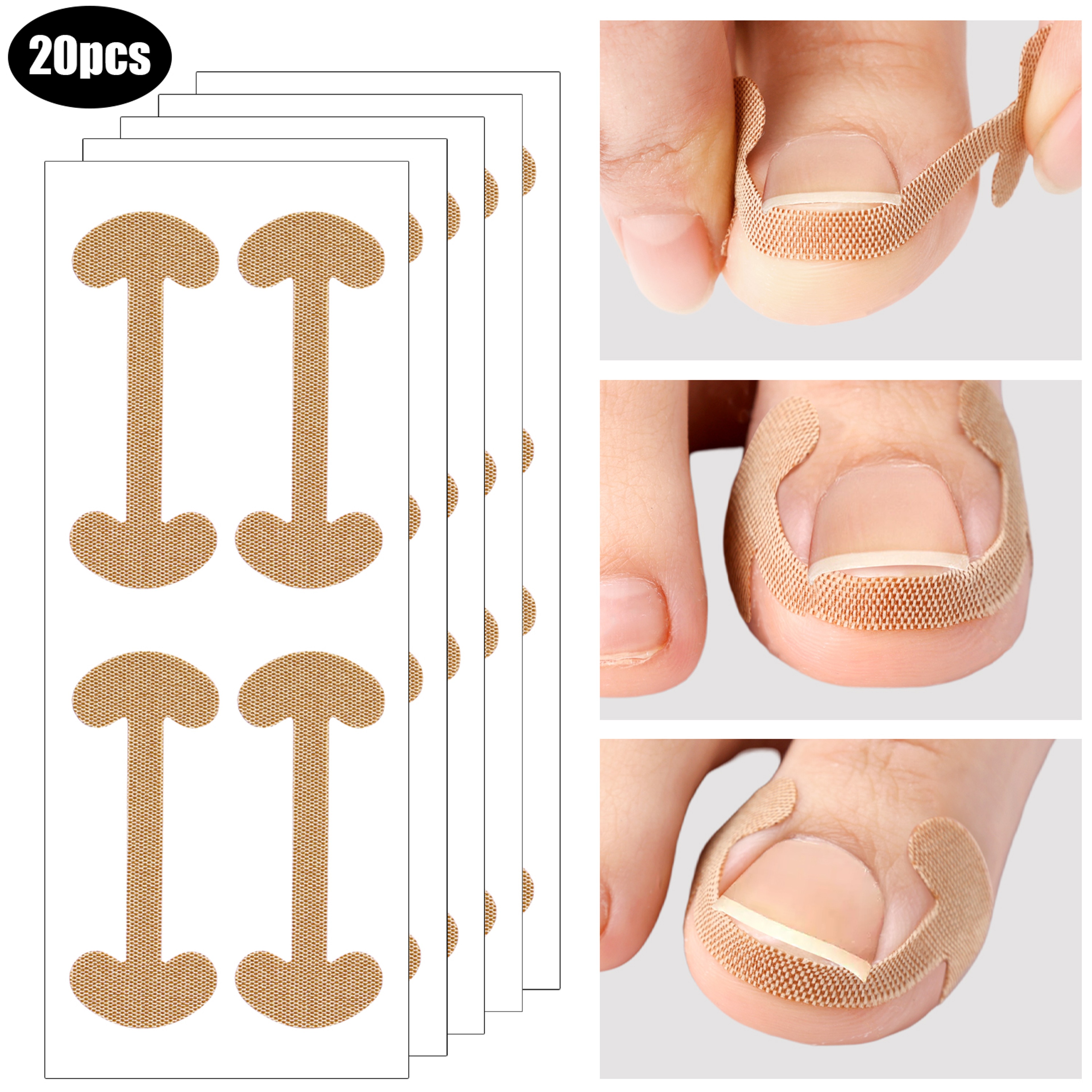 Ingrown Toenail Correction Strips Waterproof Nail Care Stickers For Comfortable Toe Support 3