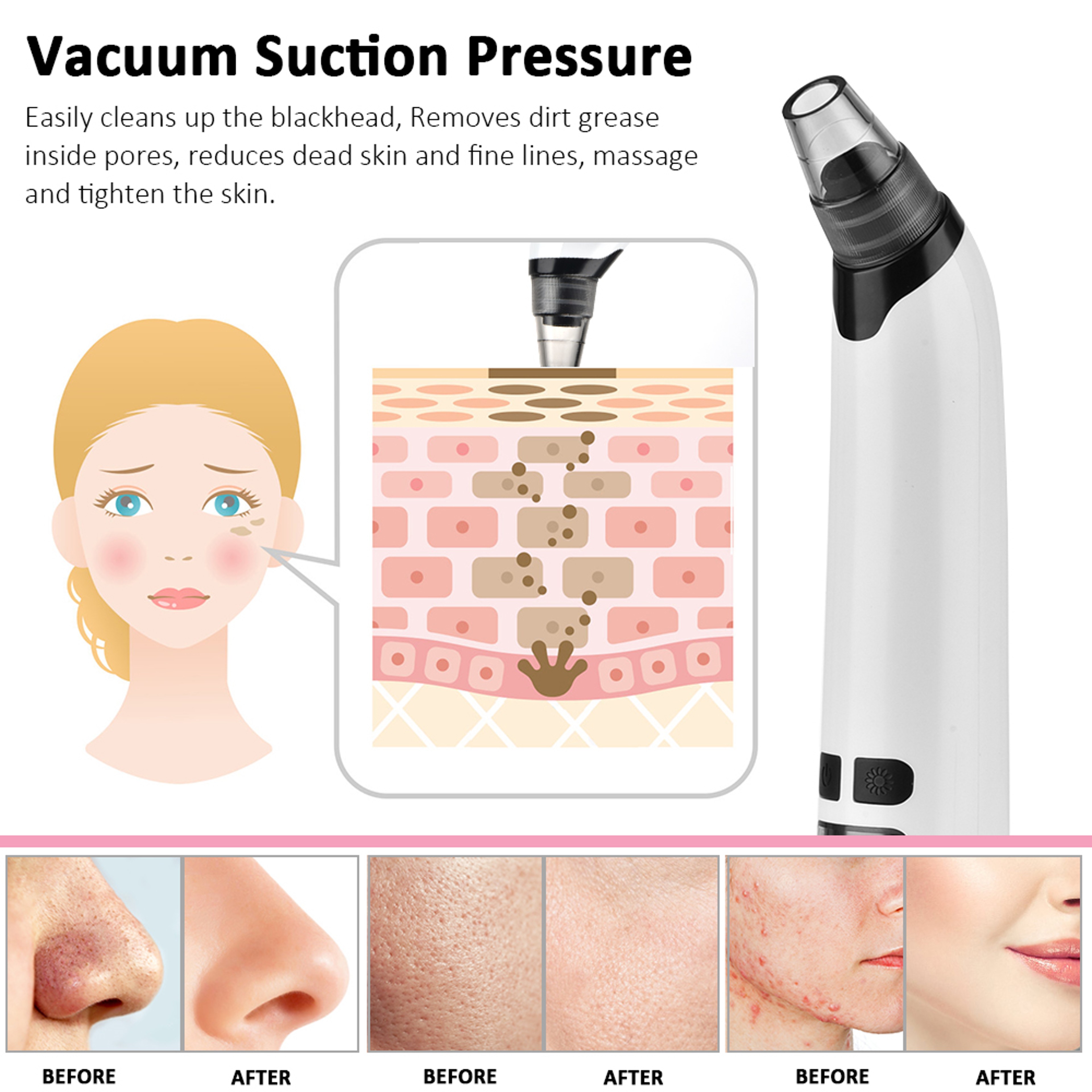 Facial Cleaner Black Point Vacuum Suction Beauty Blackhead Remover Black Head Dots Extractor Skin C 1