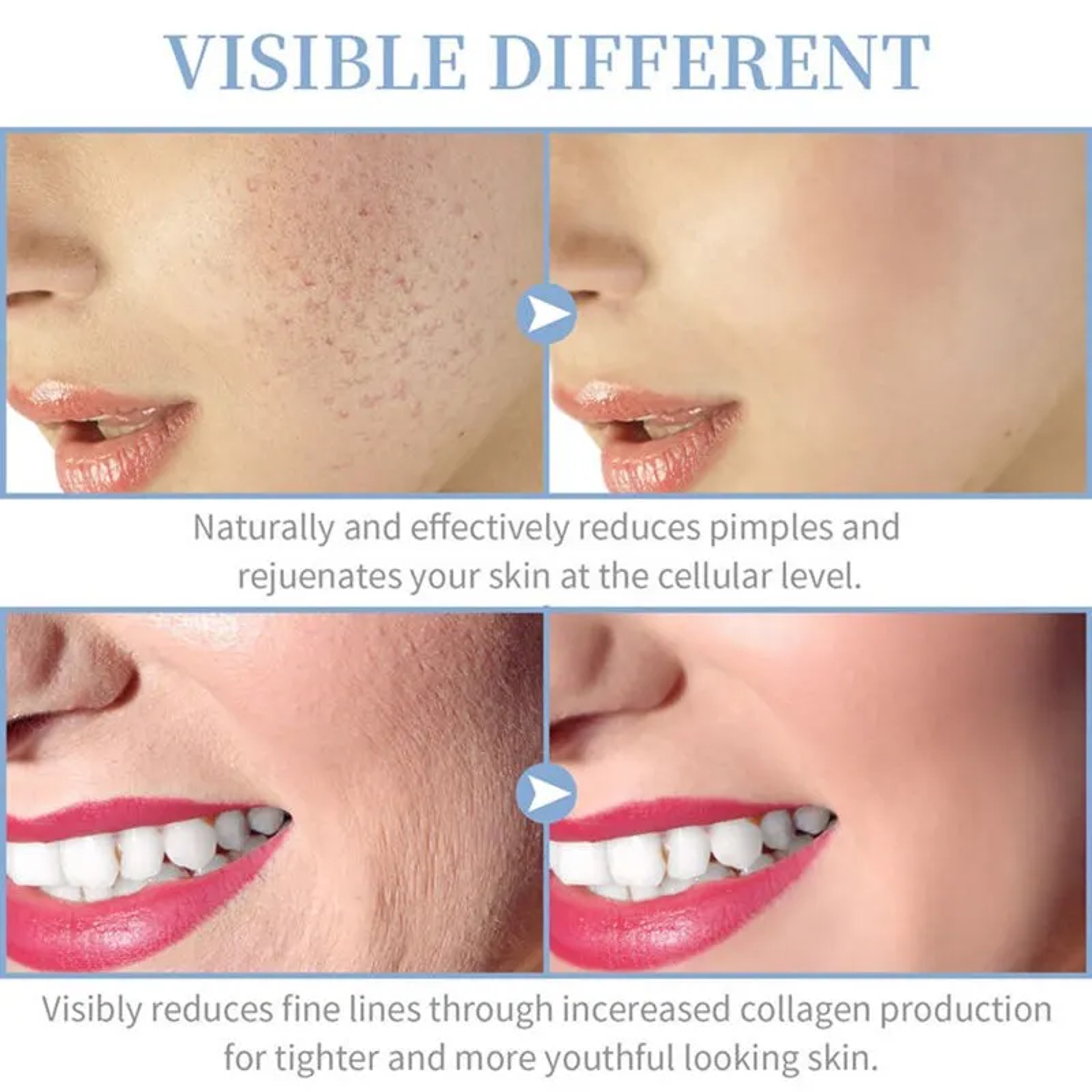 High Frequency Facial Therapy Wand Portable Acne Skin Tightening Treatment Device 1