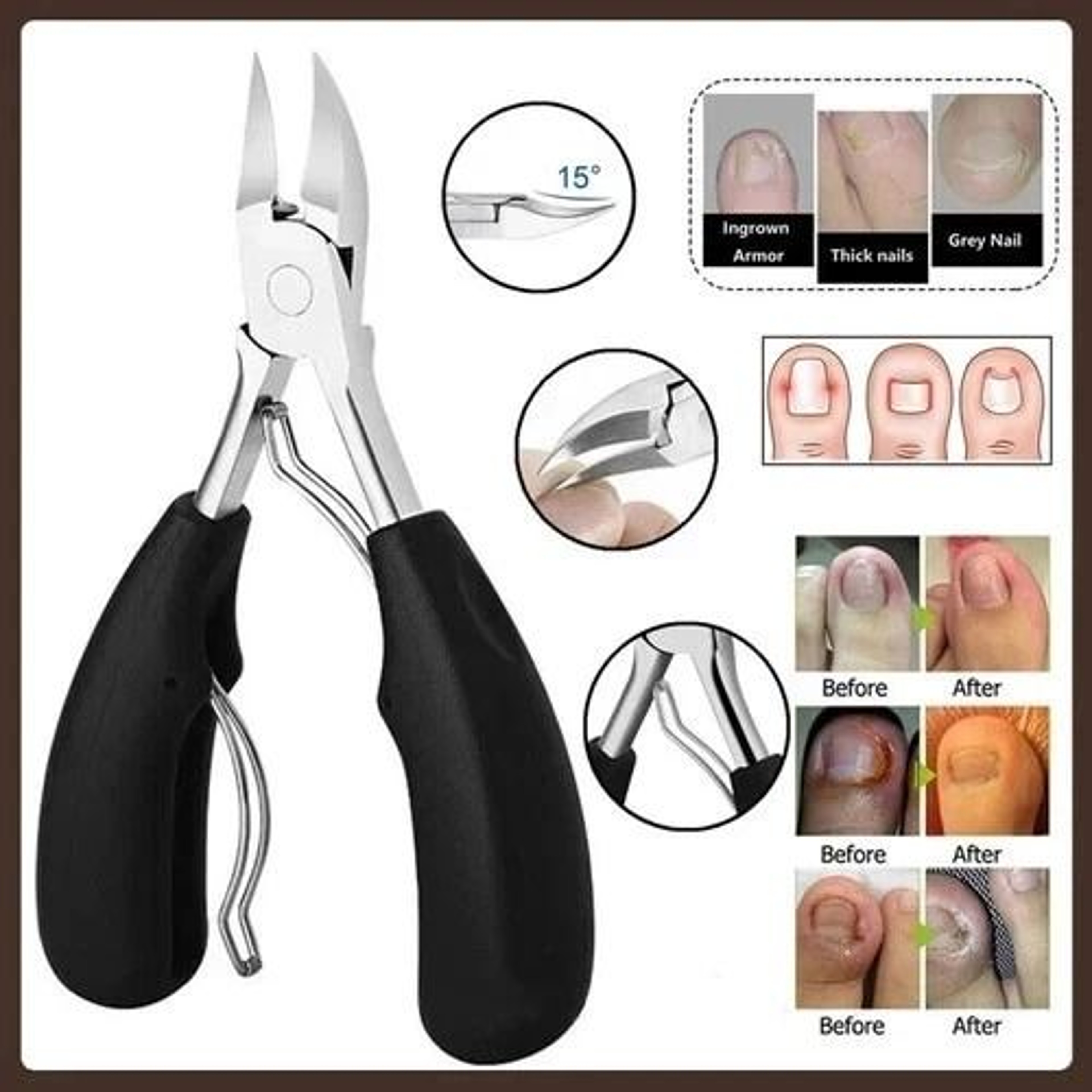 Heavy Duty Extra Large Toe Nail Clippers Stainless Professional Tool For Thick Nails Ingrown Toenai 1