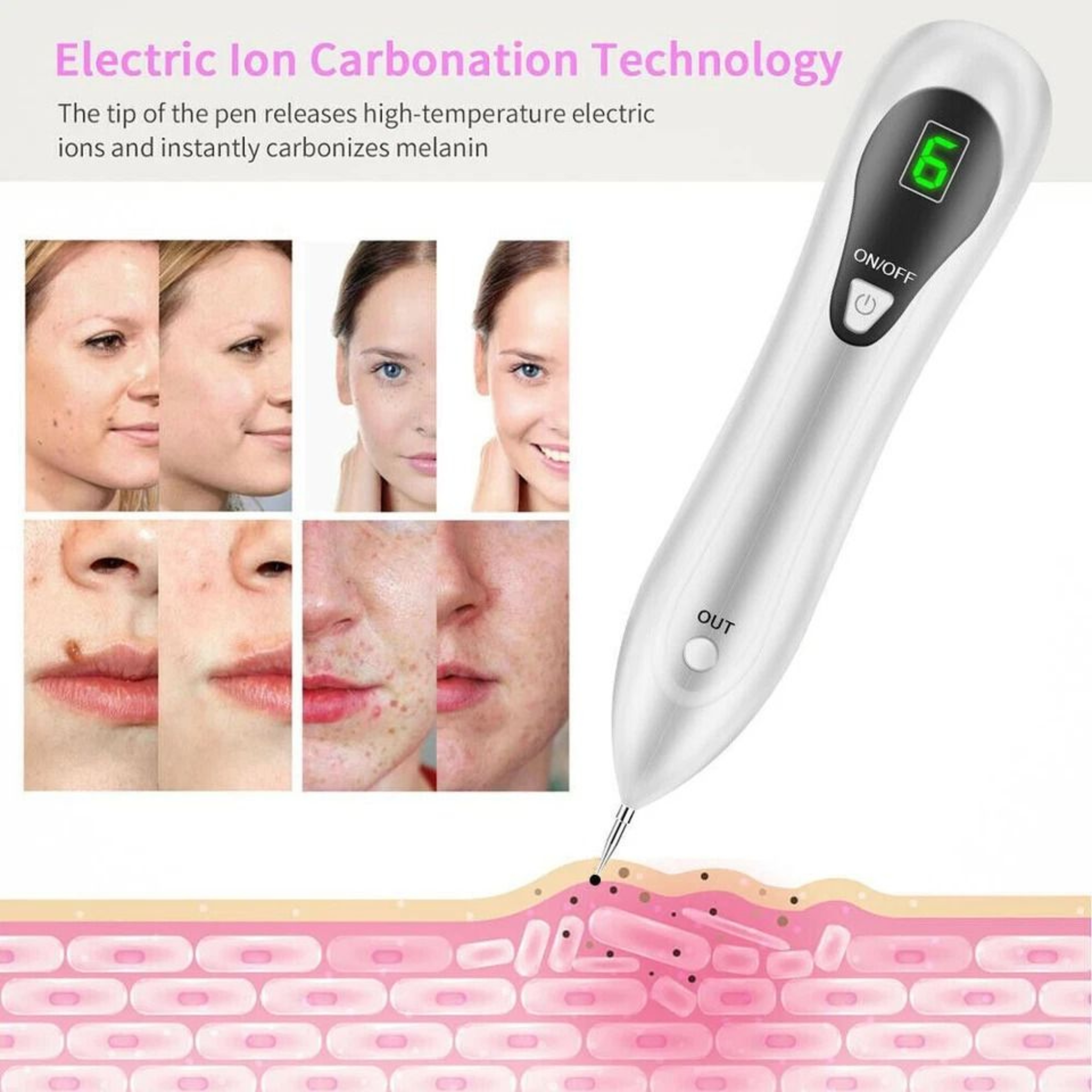 Portable Electric Laser Plasma Pen For Mole  Skin Tag Removal Dark Spot Wart  Tattoo Remover For Ho 3