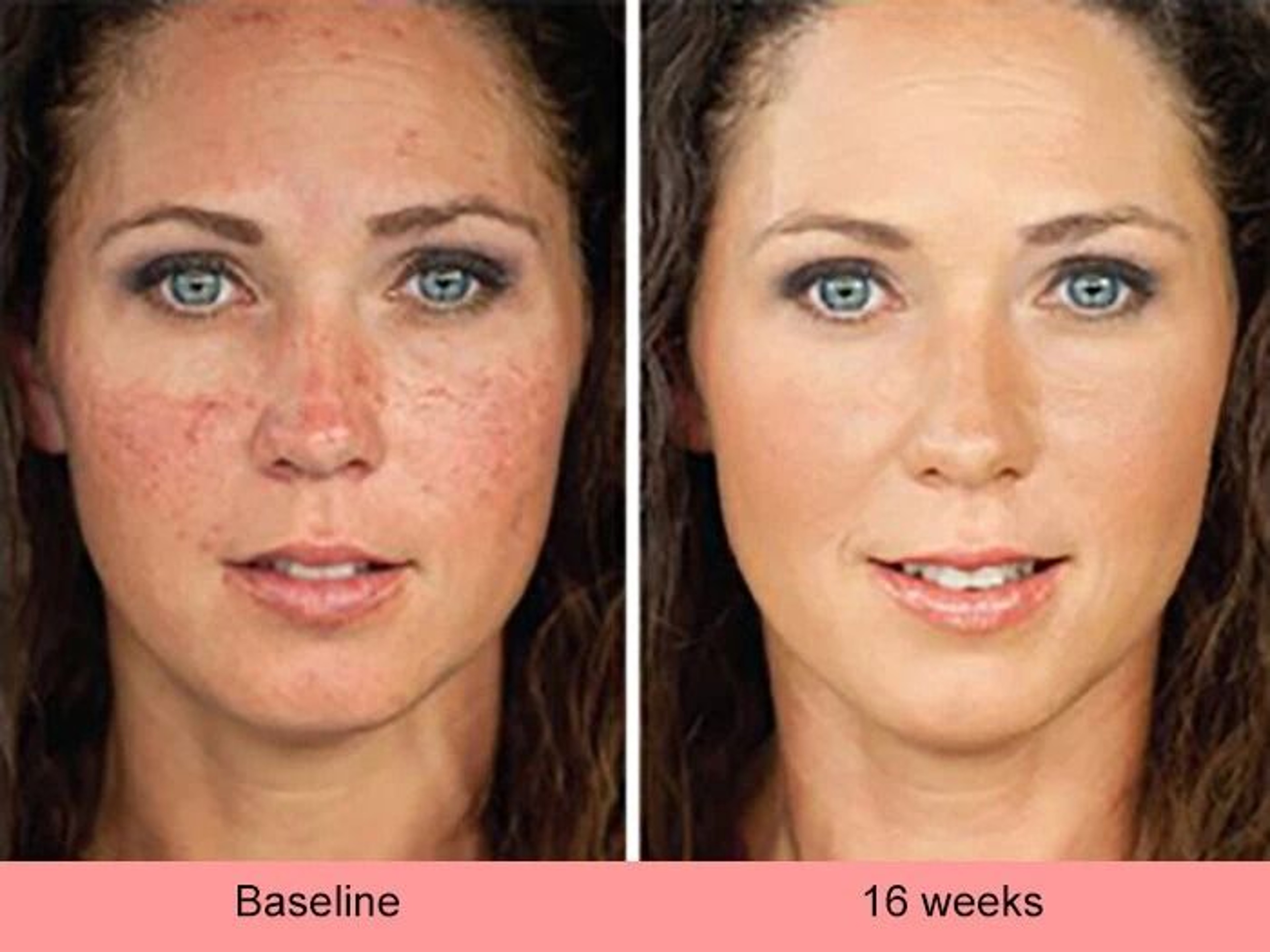 Kojic Acid Skin Whitening  Brightening Serum Dark Spot Corrector For Even Skin Tone 5