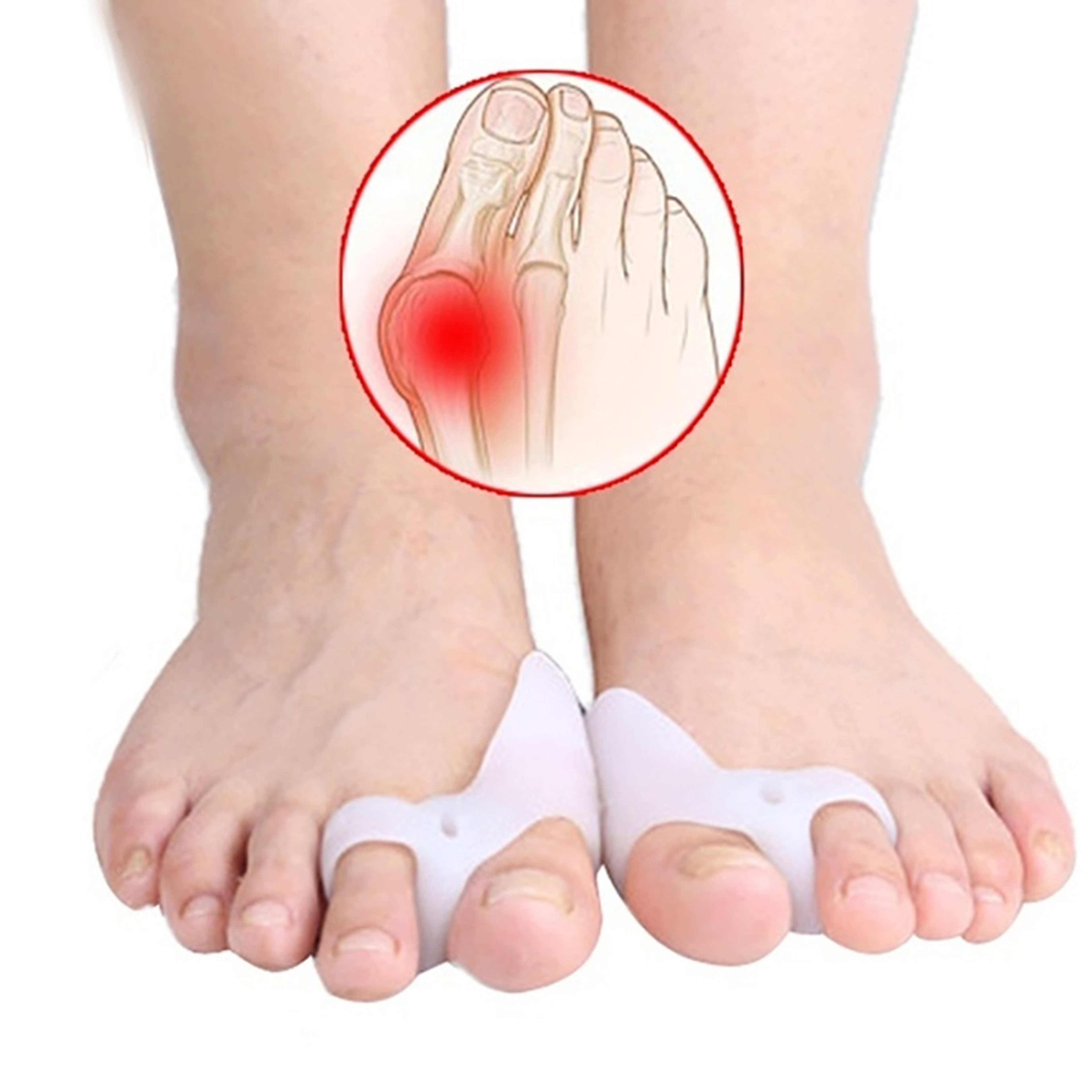 Improve Foot Health and Comfort, Silicone Toe Corrector, Hallux Valgus Buffer Toe Separator – view 2
