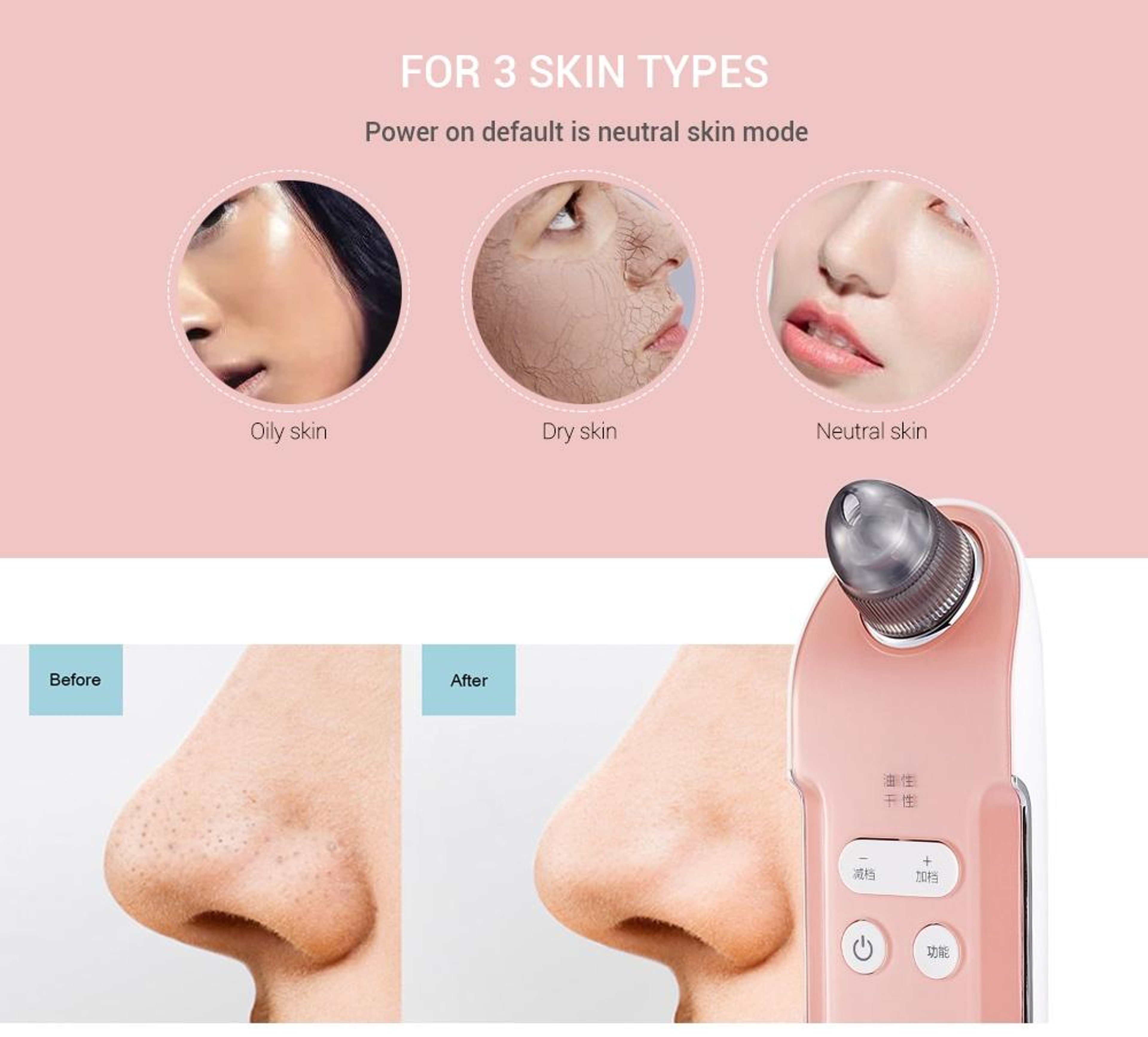 Rechargeable Blackhead Remover Pore Vacuum Facial Cleaner 6