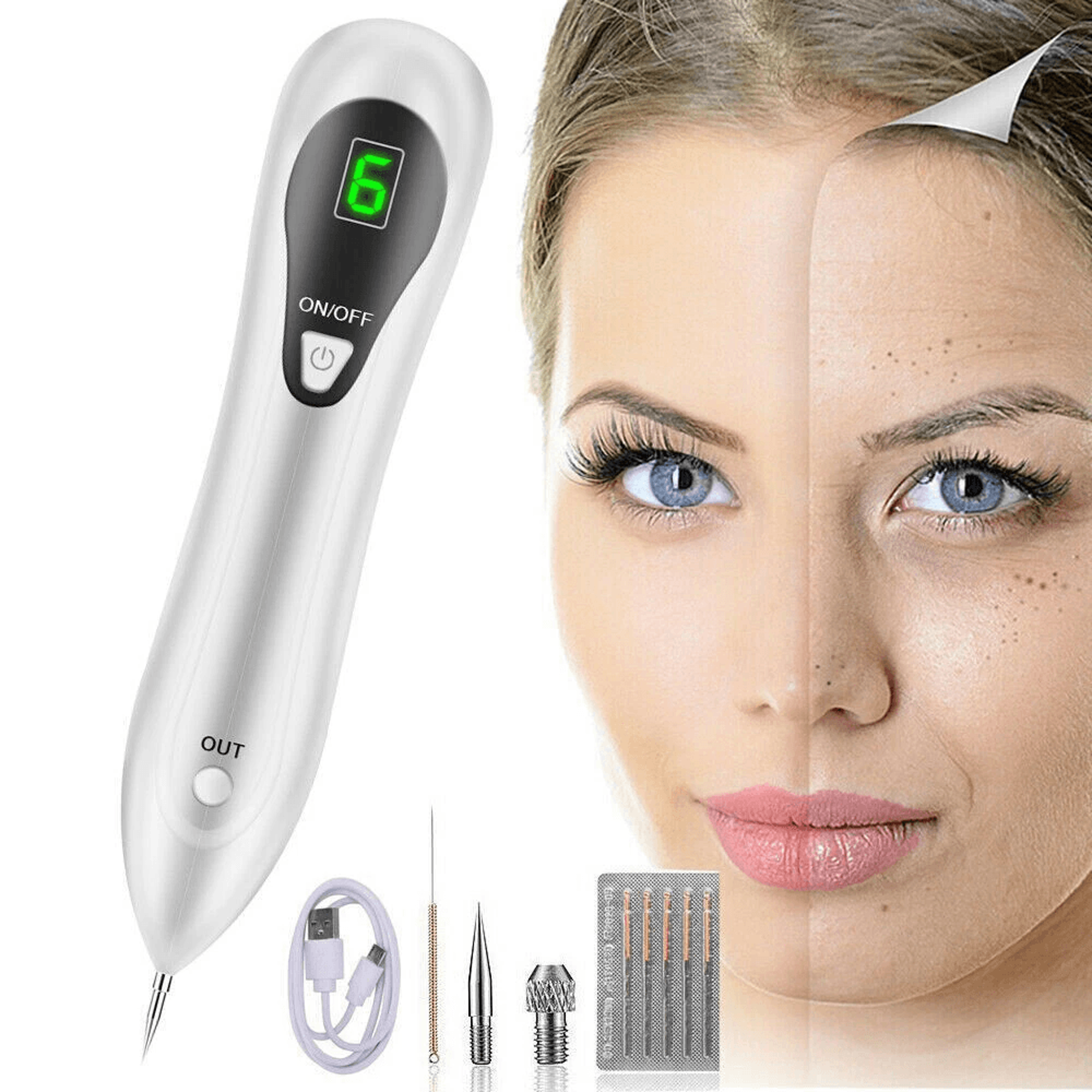 Mole Removal Electric Laser Plasma Pen For Skin Tags Dark Spots And Tattoos 0