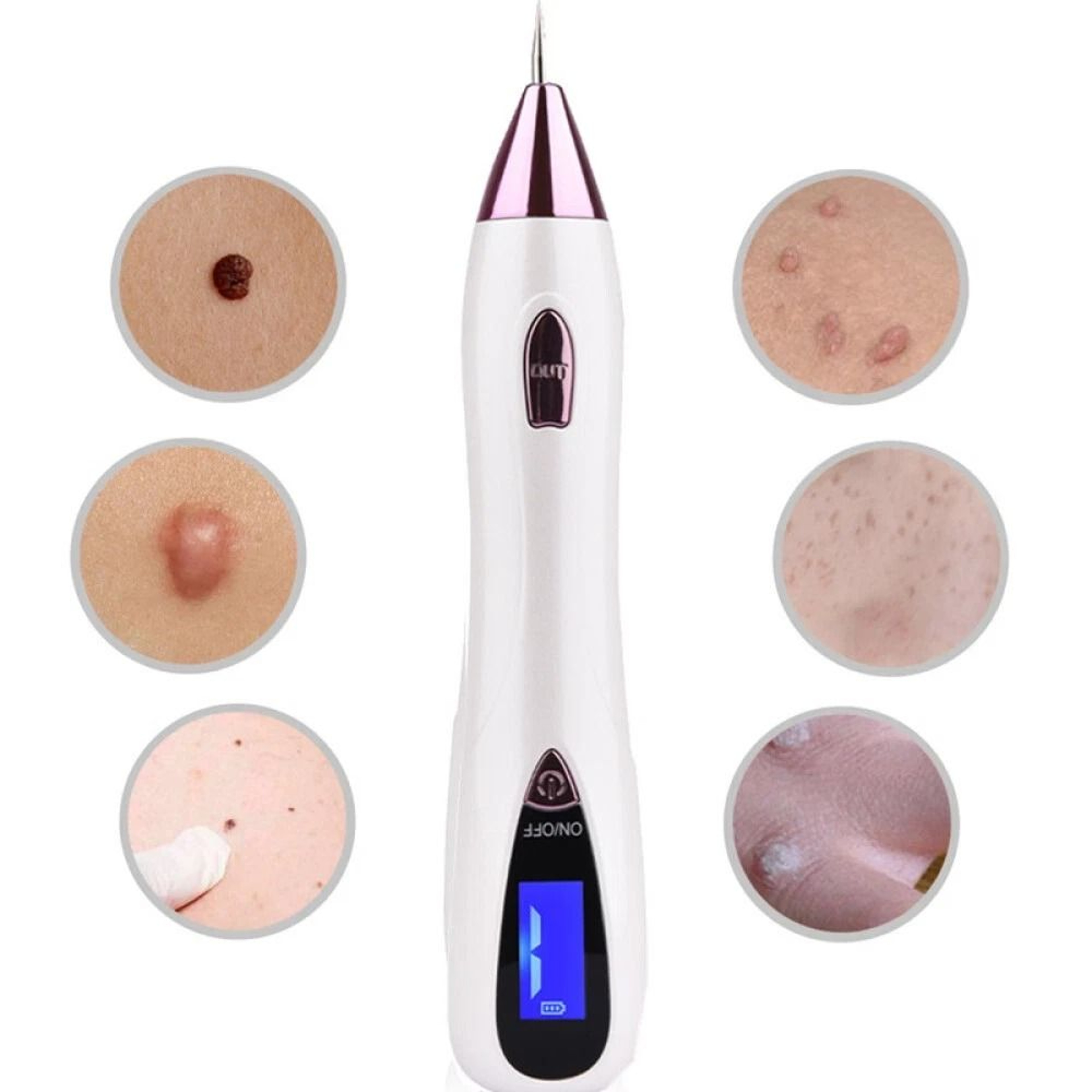 Plasma Pen AntiAging Treatment Tattoo  Wart Remover Skin Tag Solution 0