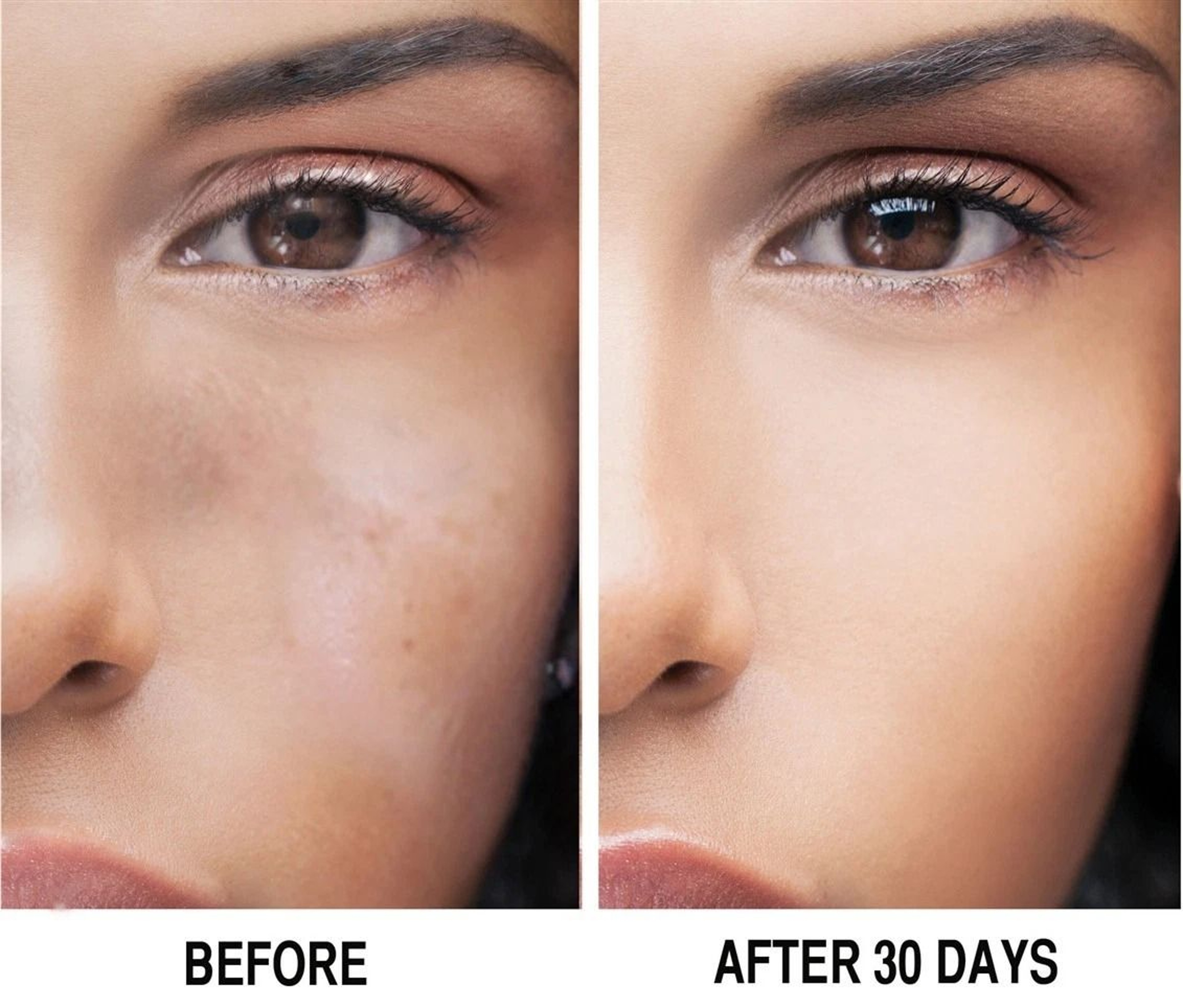 Kojic Acid Brightening Serum 1oz Dark Spot Treatment  Uneven Skin Tone Solution 4