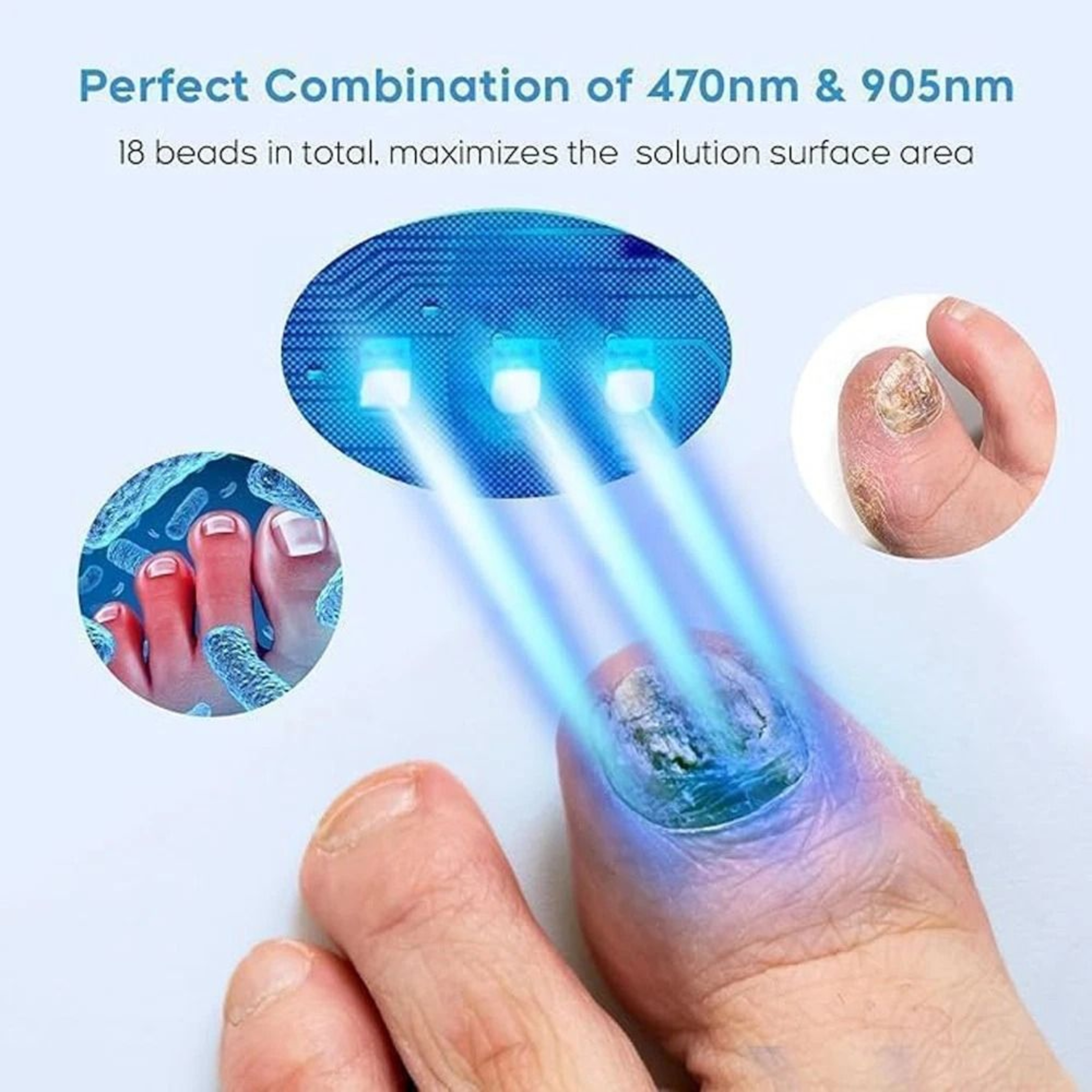 Rechargeable Nail Fungus Light Device For Toenails LED Nail Therapy For Multiple Nails 11