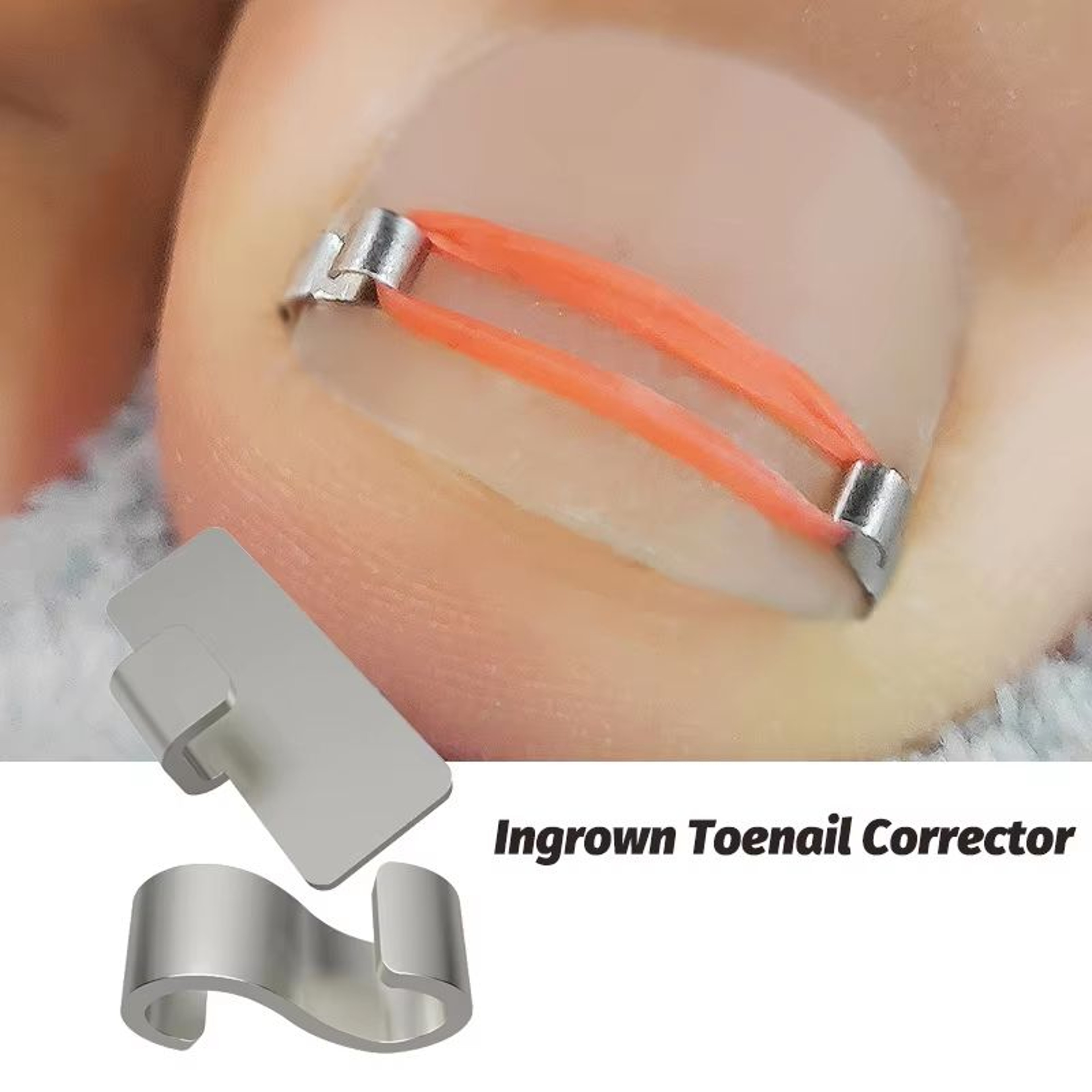 Professional Ingrown Toenail Corrector Tool Set  Pedicure Treatment  Foot Care Kit 0