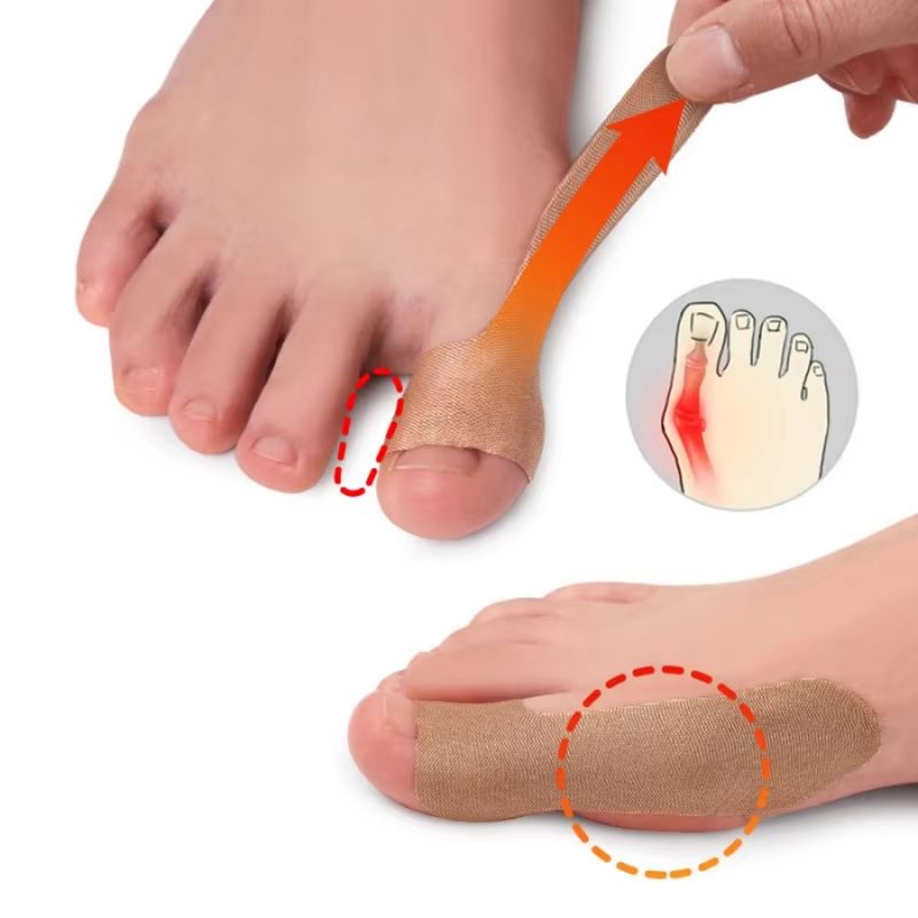 Big Toe Valgus Orthopedic Patch Pain Relief  Protection Set 2