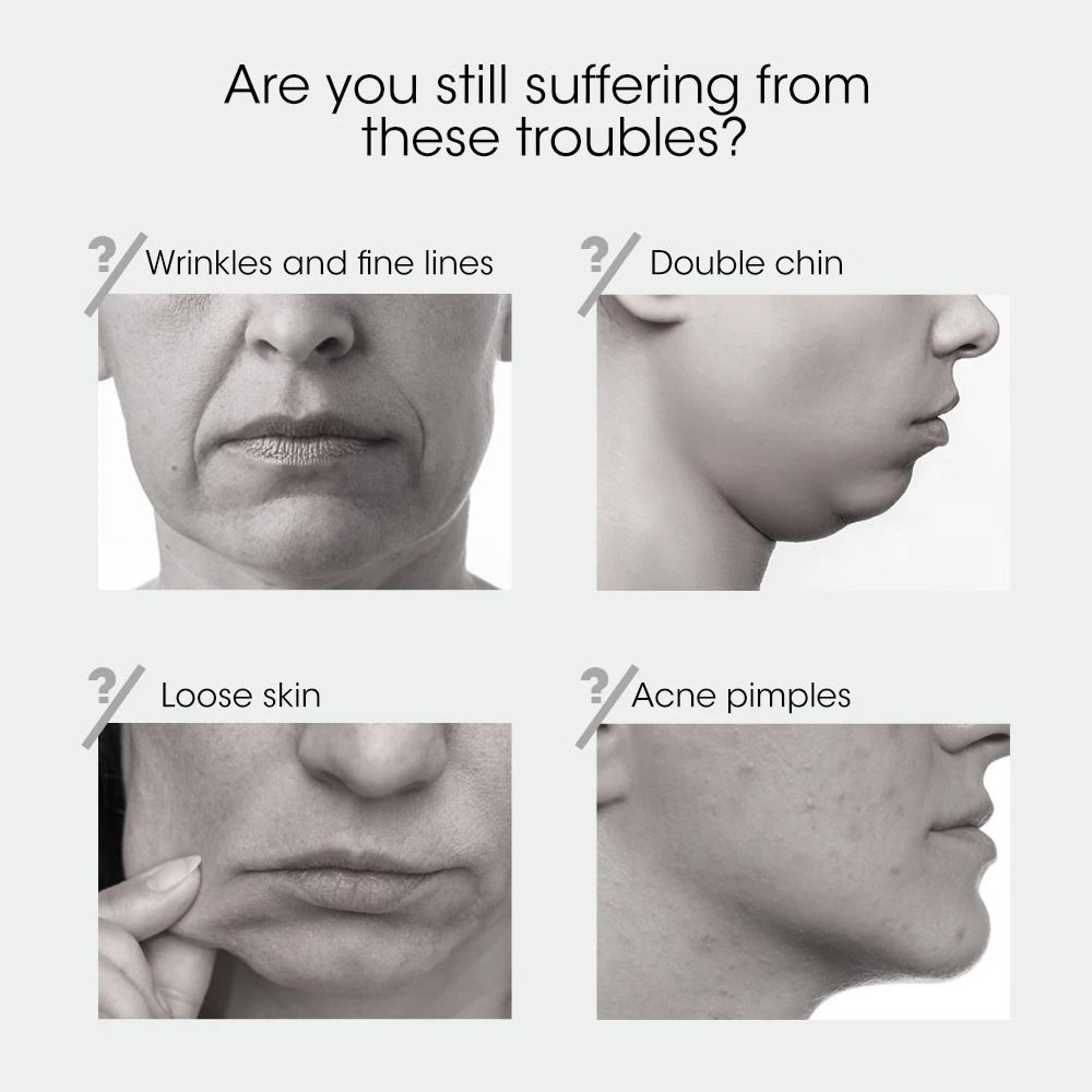Face Lifting Device Red Light Skin Rejuvenation V Face Massager Double Chin Lift Up Remote Control 5