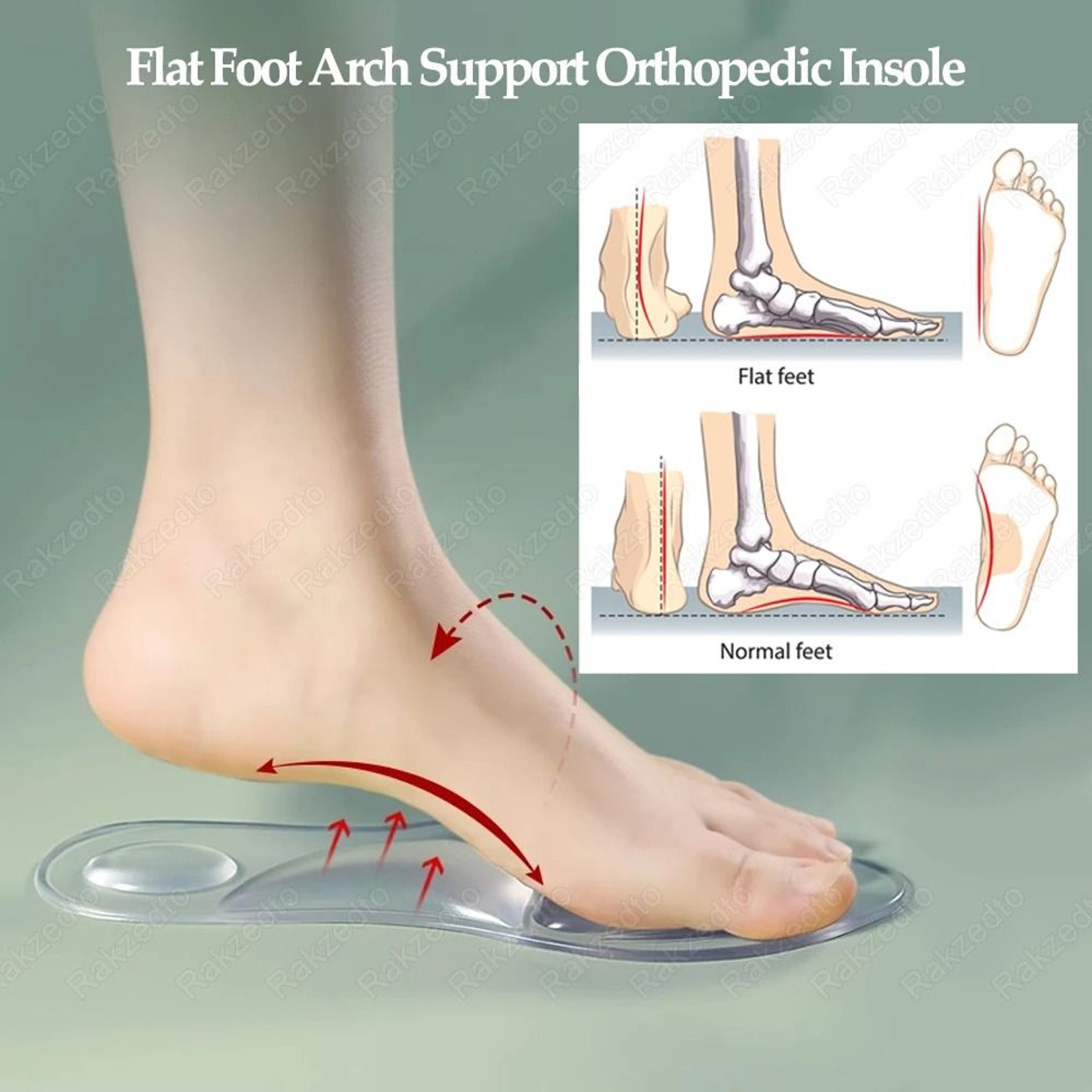 Medical Silicone Orthopedic Arch Support Insoles For Flat Feet And Plantar Fasciitis Relief 3