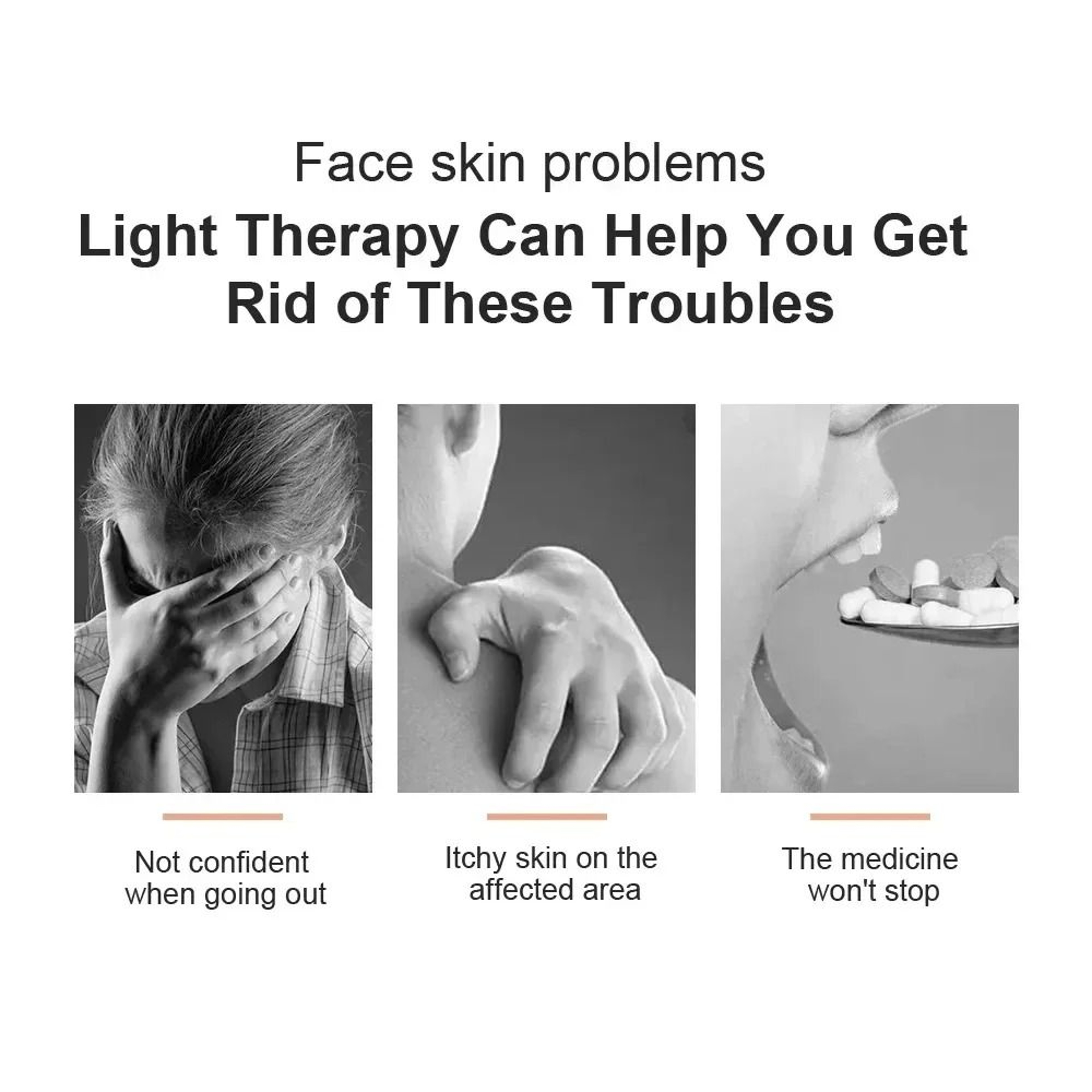 UVB 311nm Narrowband Phototherapy Lamp For Psoriasis  Vitiligo 2
