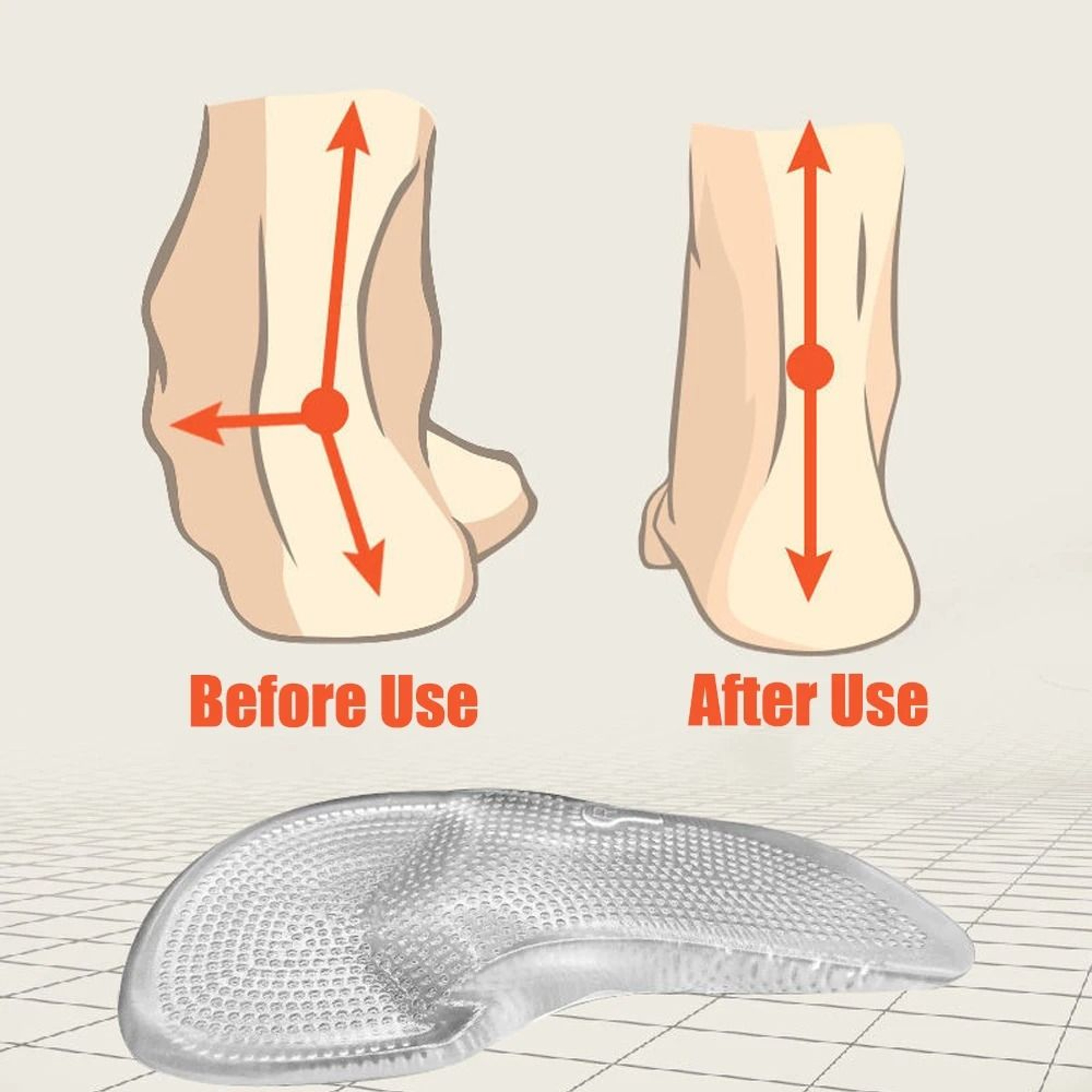 Silicone Gel Orthopedic Insoles For Arch Support And Foot Pain Relief 3