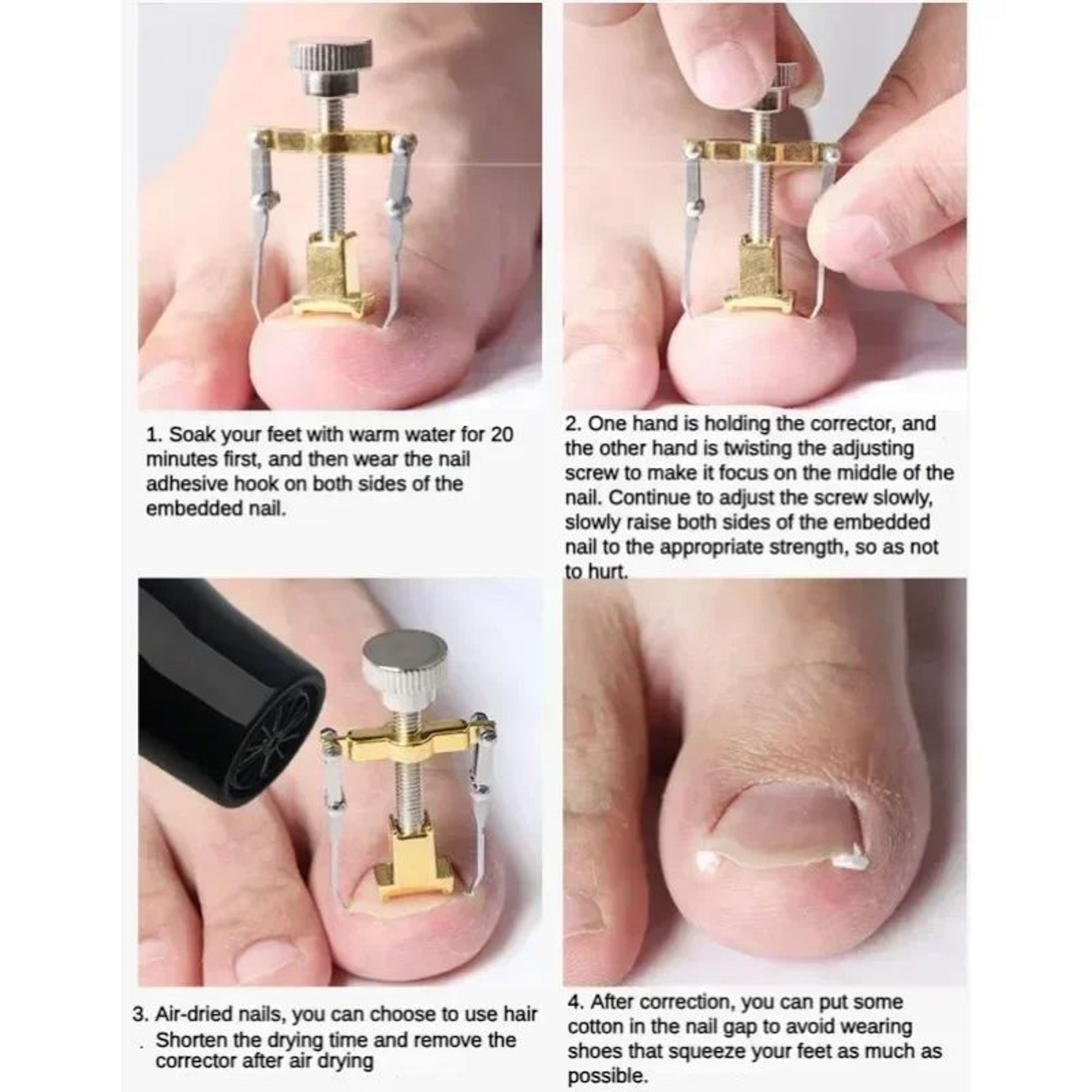 Ingrown Toenail Treatment Clip Pedicure Tool For Foot Care Stainless Steel Onyxis Correction Straig 5