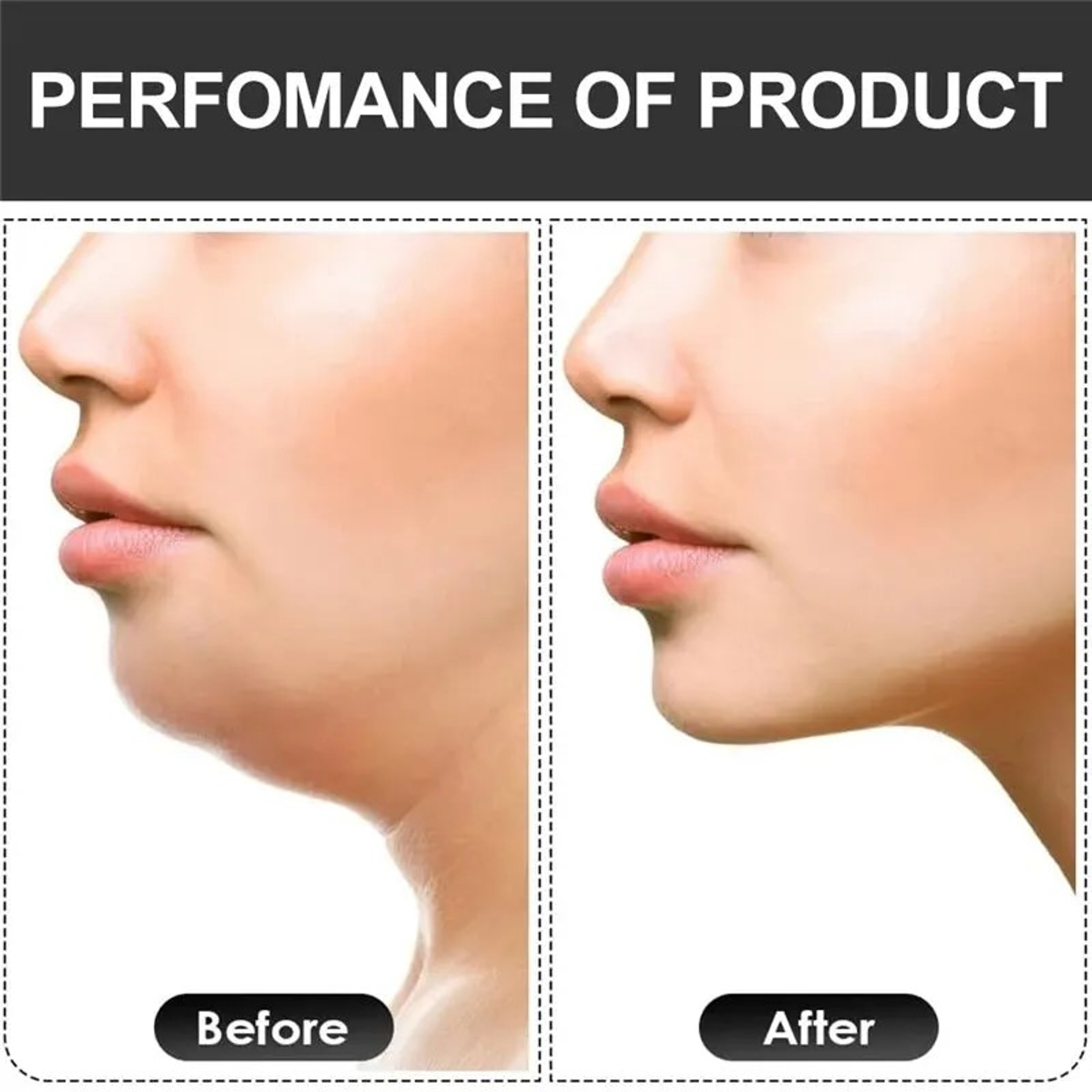 U Shape Jaw Exerciser Jawline Trainer Facial Muscle Fitness Tool 5