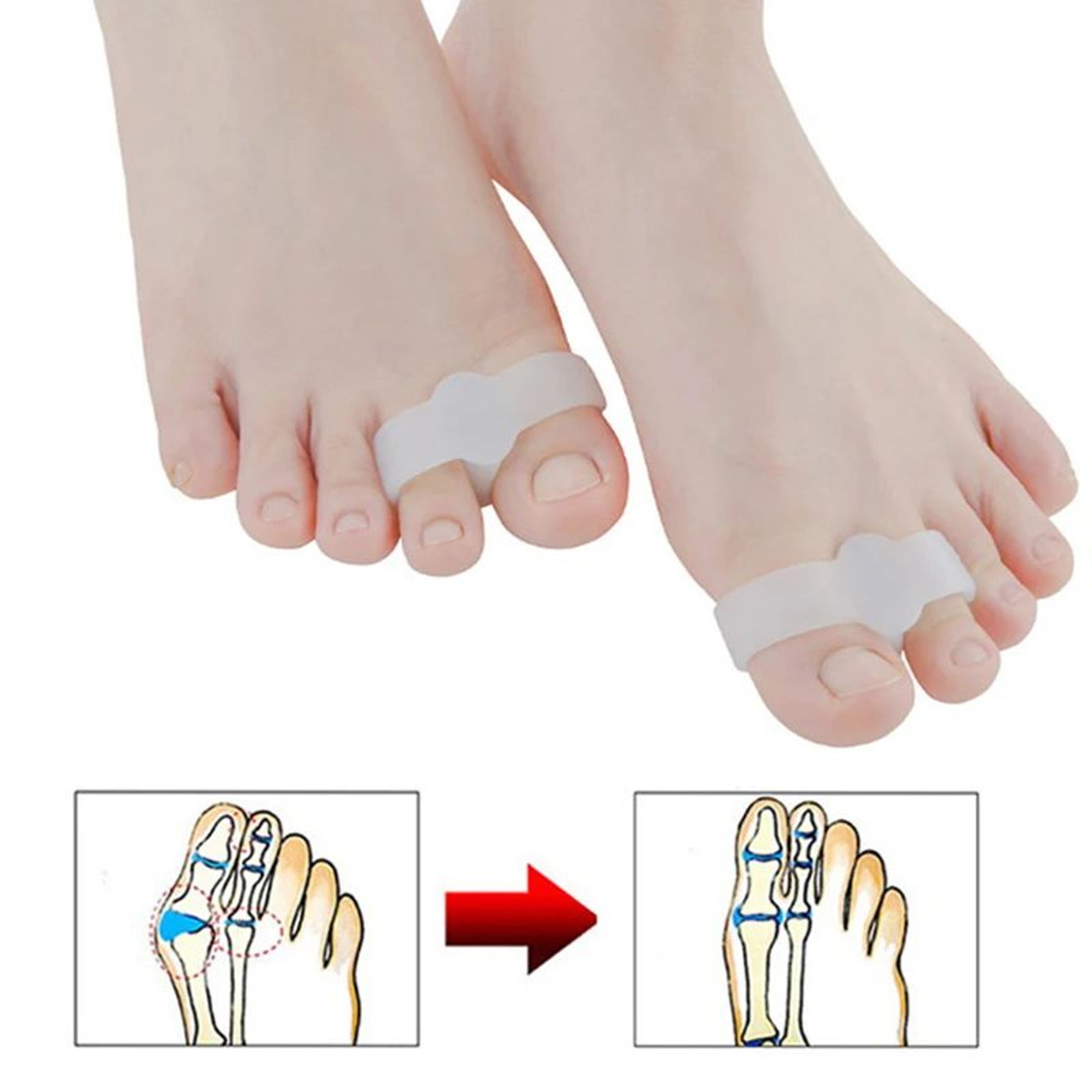 Silicone Big Toe Separator 2 Pack Gel Toe Corrector And Protector 4