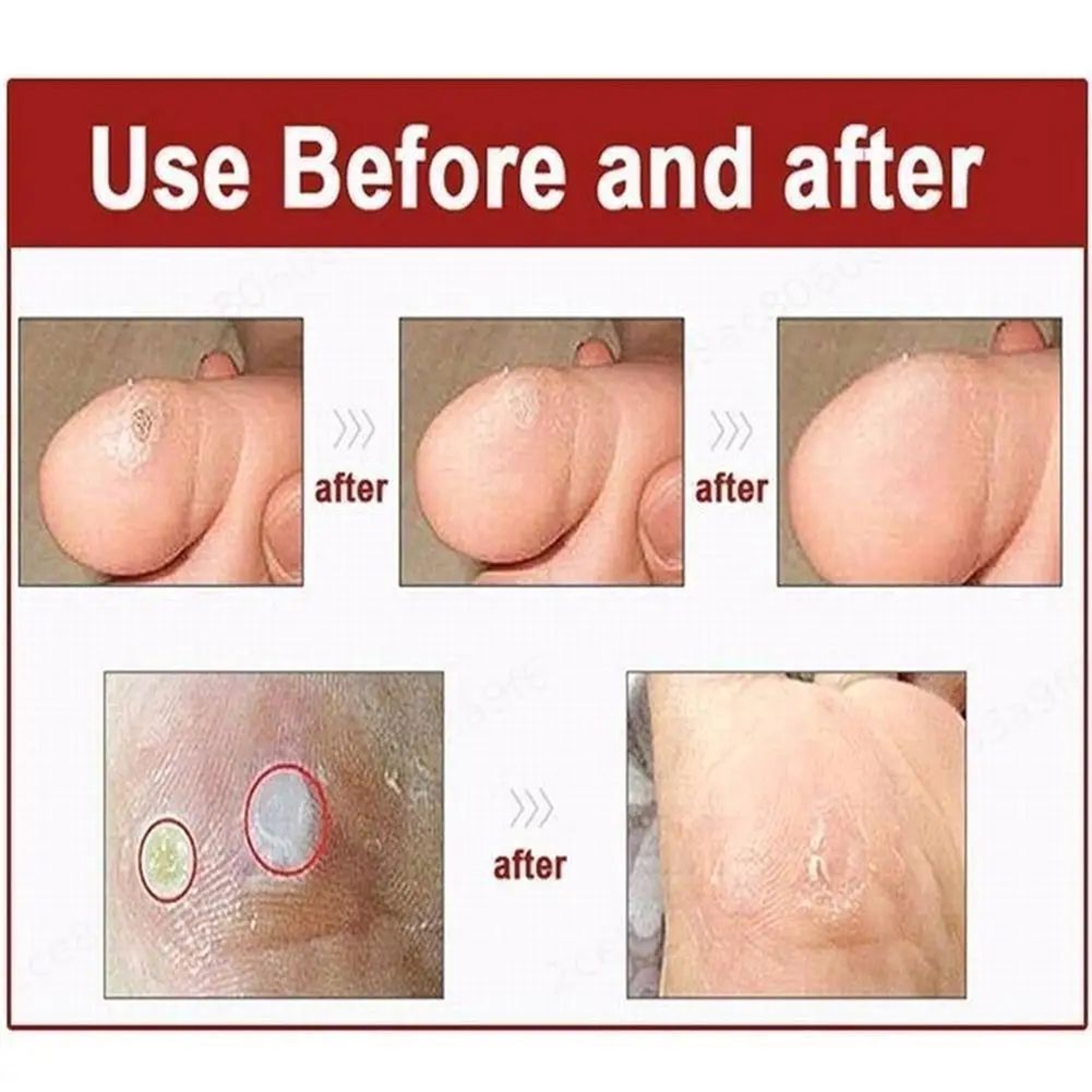 6 Pcs Foot Corn And Callus Protector Pads 3