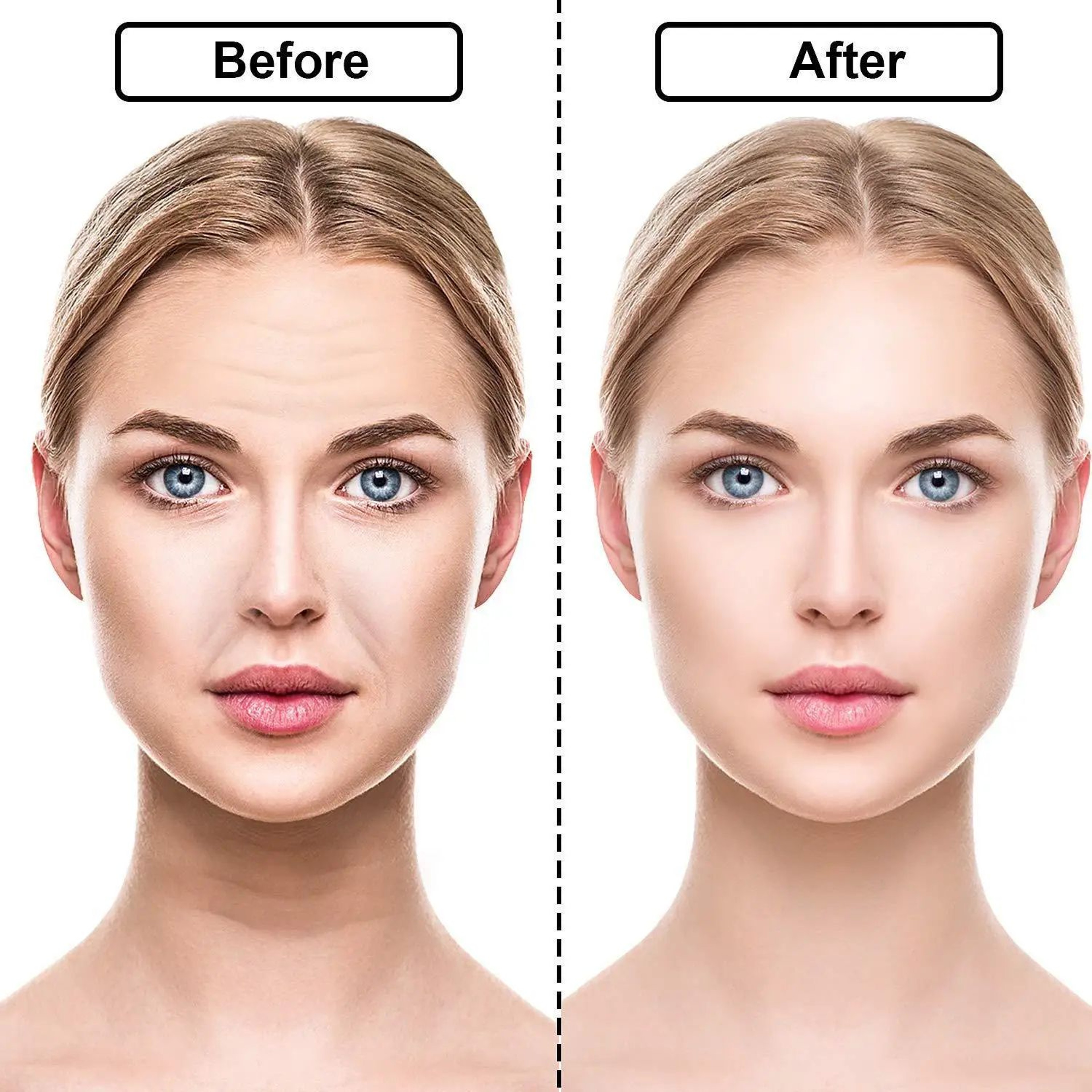 Reusable Silicone Anti Wrinkle Face And Neck Patches Set 4