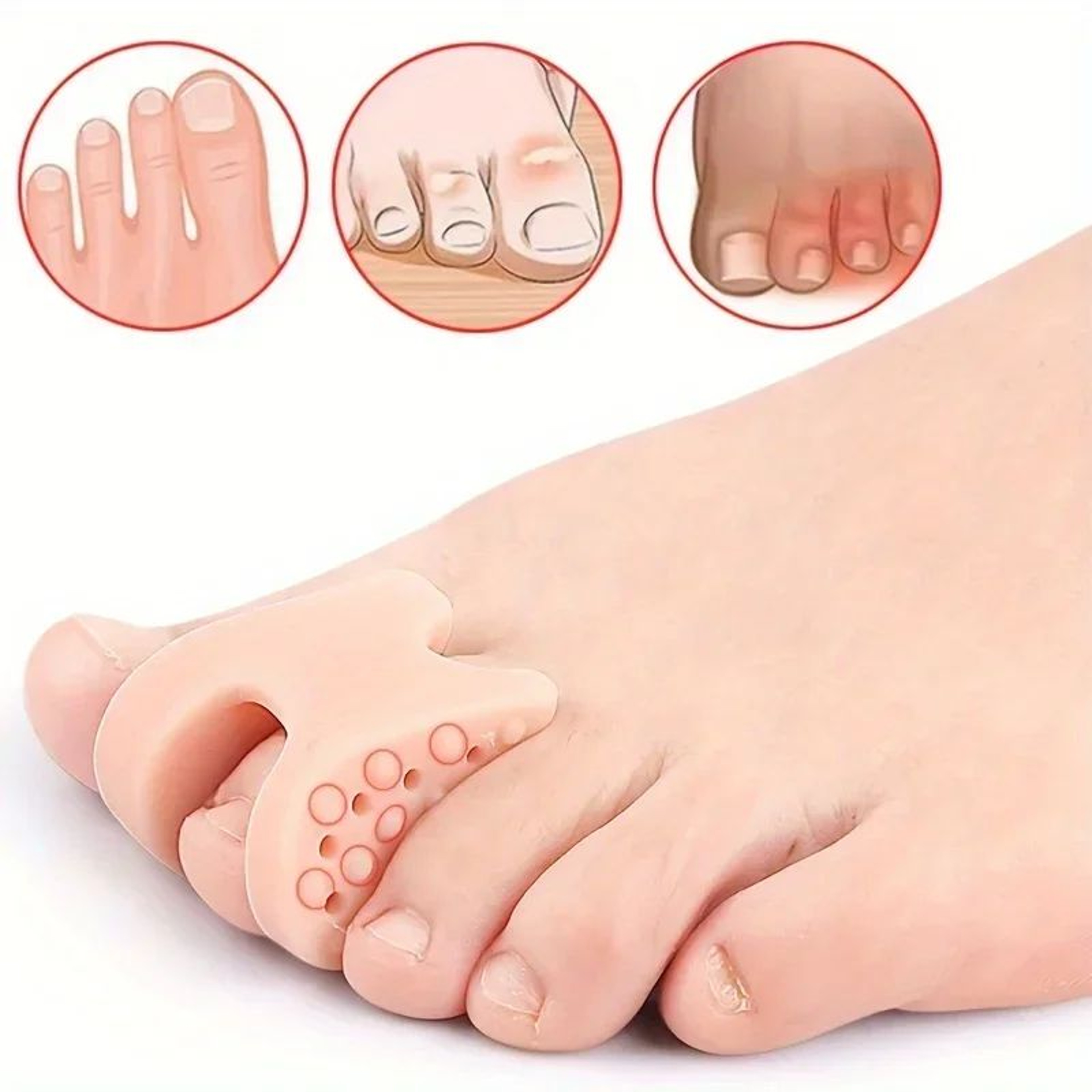 ComfortAlign Silicone Toe Spacers  Big Toe Separator  Gel Bunion Corrector Pads 2
