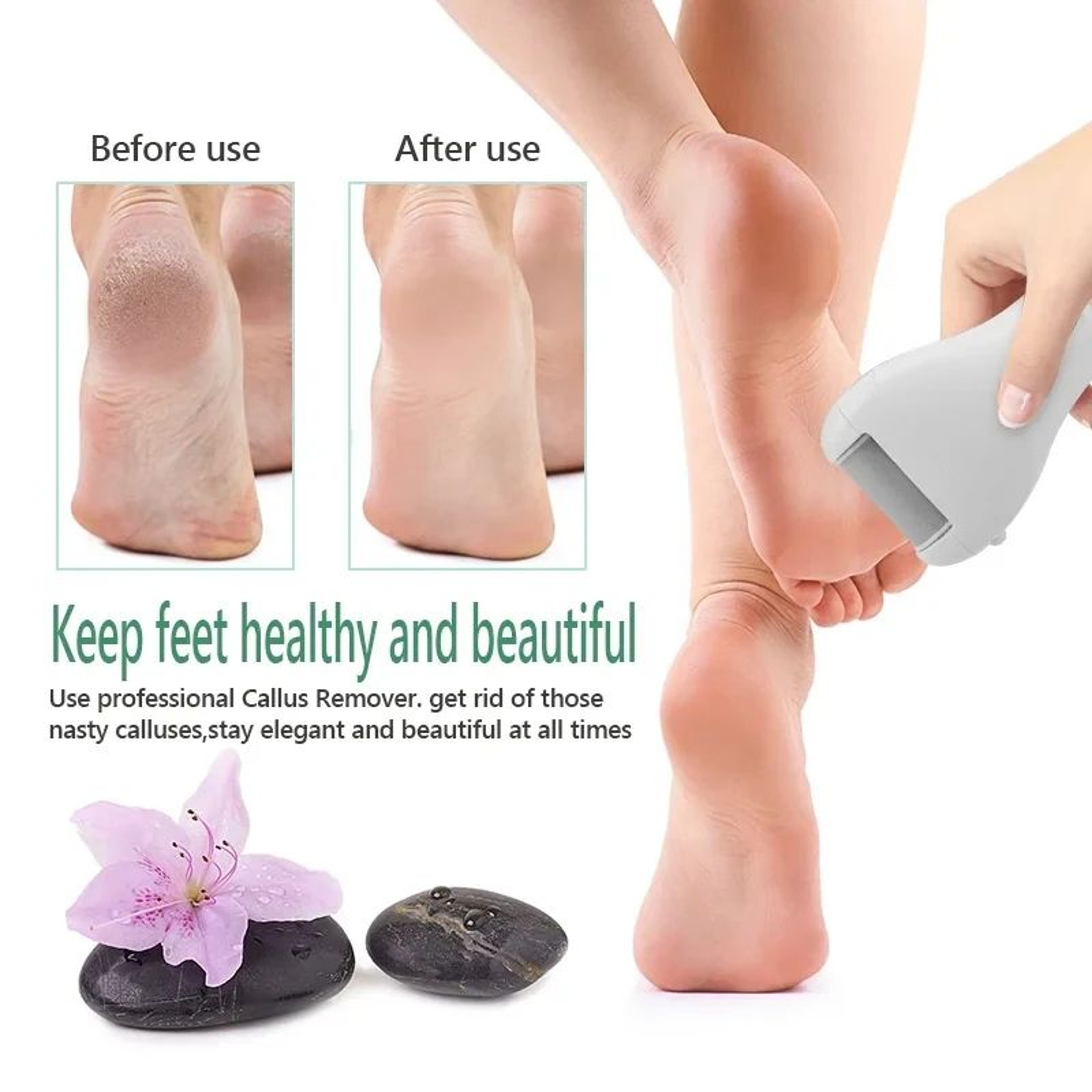 Rechargeable Electric Foot File Callus Remover Pedicure Tool With LED Power Display And 3 Roller He 3
