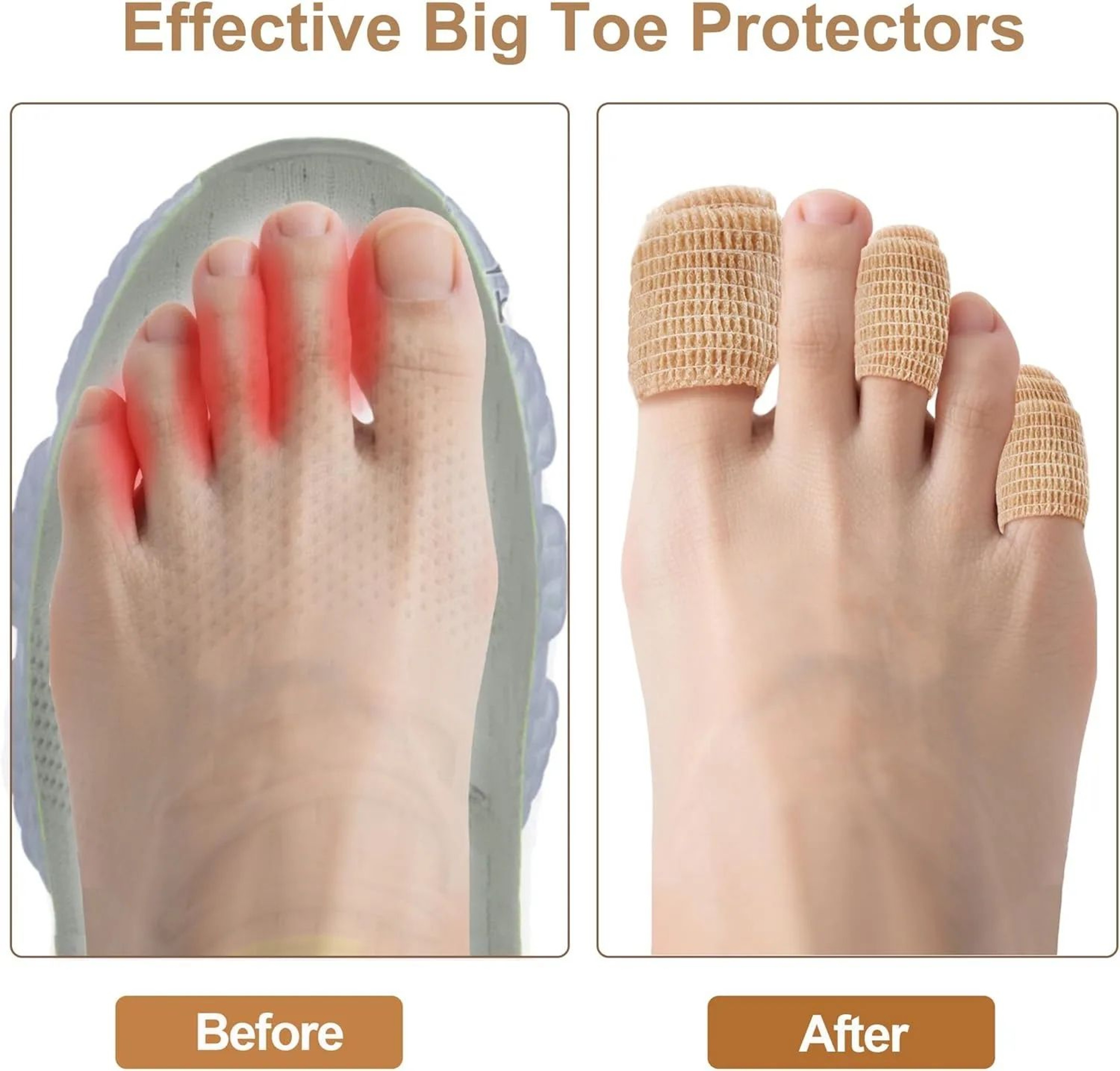 ComfortFlex Toe Bandage Wrap Self Adhesive Toe Protection Tape For Big Toe Fingers And Thumb 2