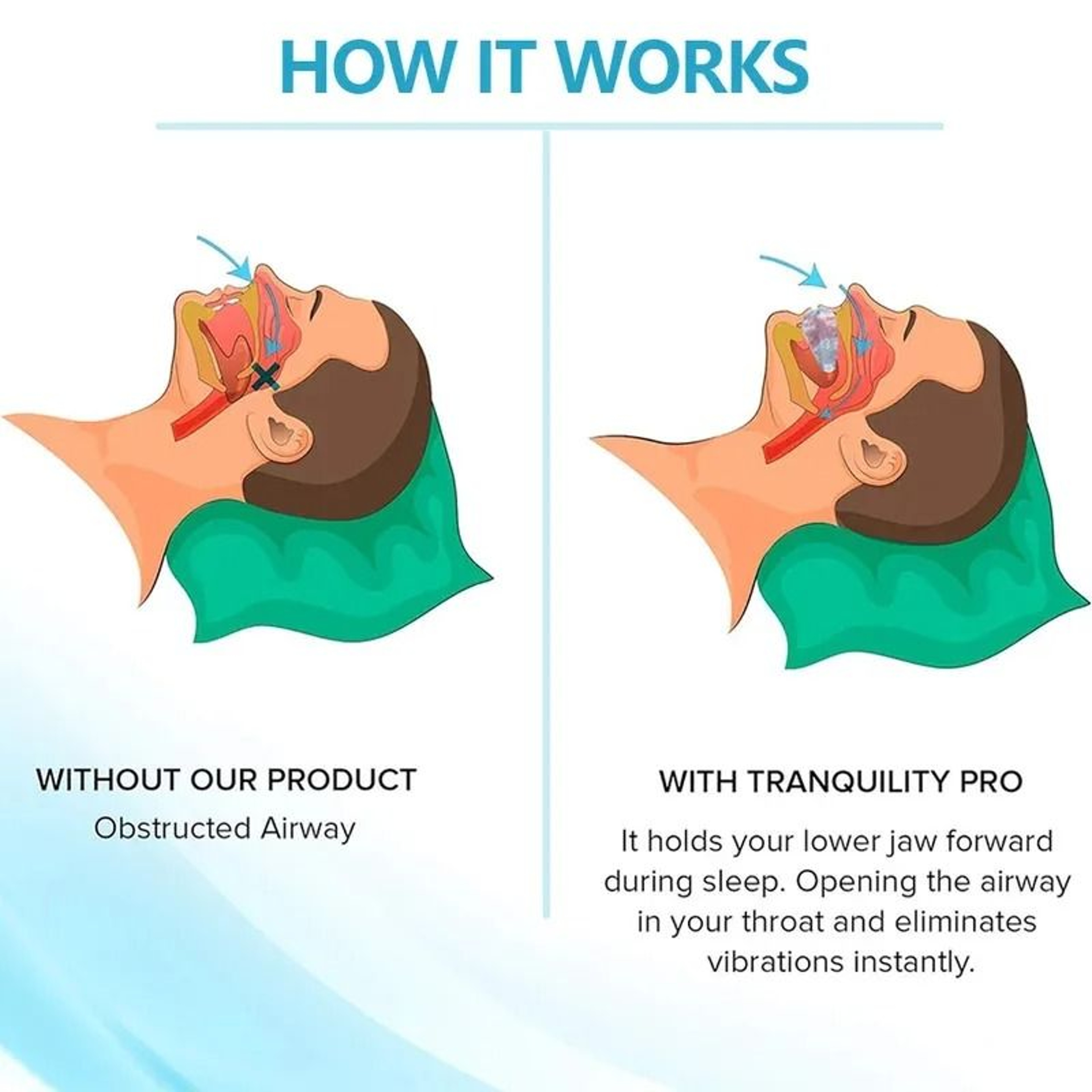 Anti Snoring Bruxism Mouth Guard For Teeth Grinding And Better Sleepc 2