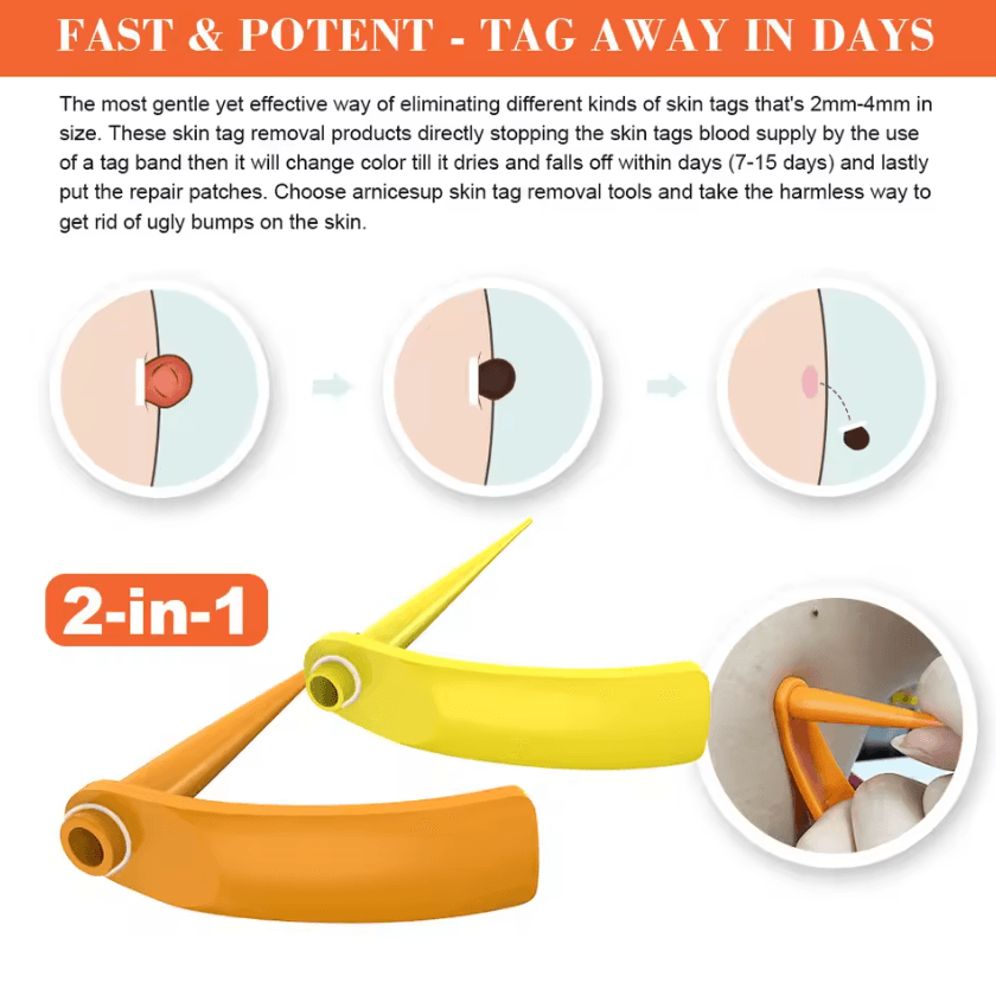 2in1 Skin Tag  Wart Removal Pen Kit  Precision Facial Care Tool With Cleansing Swabs 2