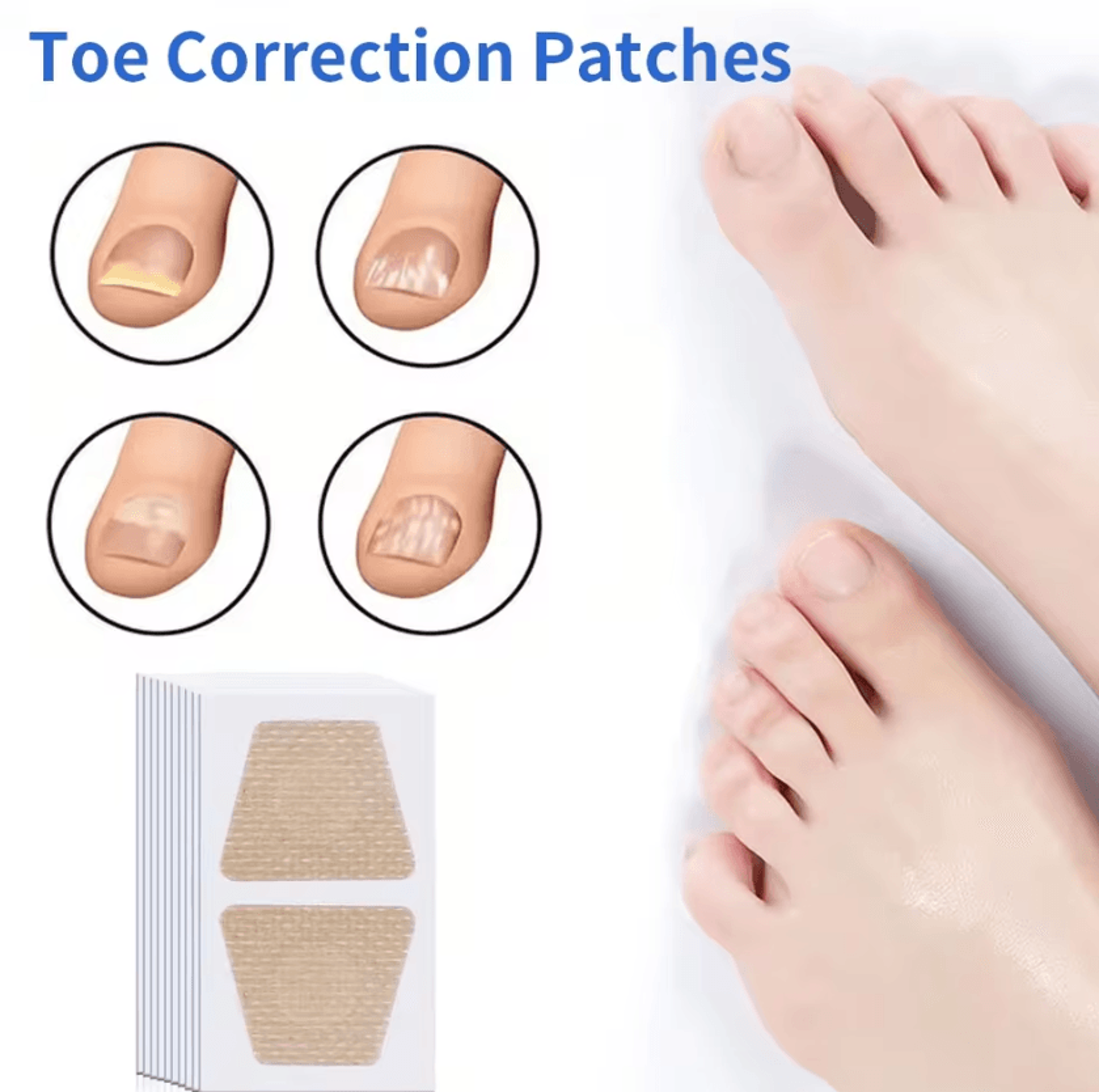 Toenail Care Repair Patches Adhesive Nail Stickers For Discolored Damaged And Ingrown Toenail Maint 1