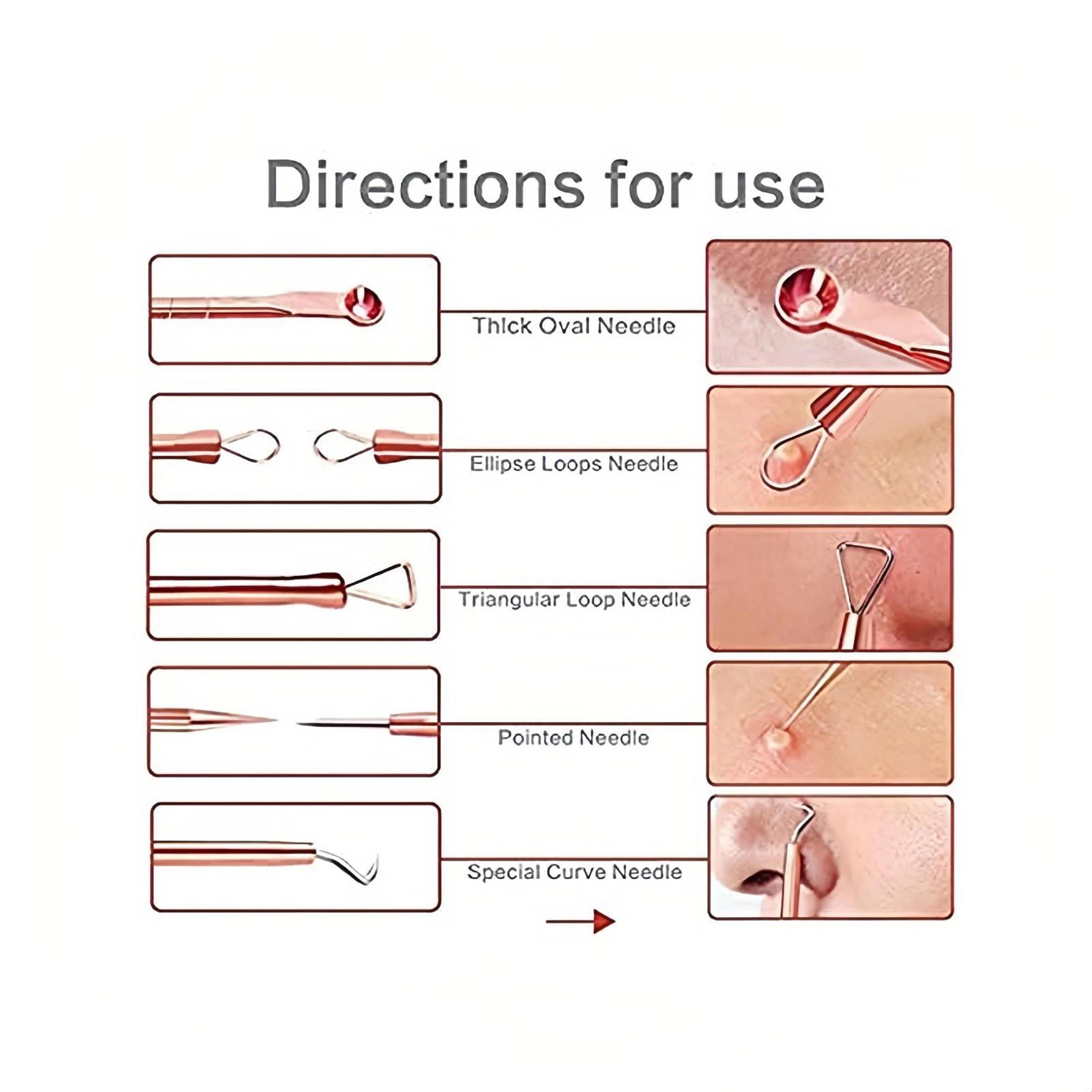 Precision Stainless Steel Blackhead Remover Tool Set For Acne Whiteheads  Milia Extraction 3