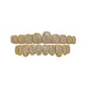 Iced Out 10 Top and 10 Bottom Gold Plated CZ Teeth Grillz