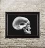 x-ray-of-a-human-skull.jpg