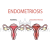 ENDOMETRIOSIS NORMAL FEMALE [site].png