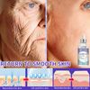 Effective-Anti-Ageing-And-Anti-Wrinkle-Facial-Serum-To-Remove-Facial-Wrinkles-Fine-Lines-Around-The.jpg