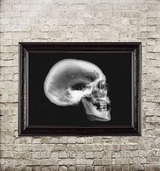 X-ray of a human skull. Anatomical art print. Black and white poster. Dark style gift. 572.