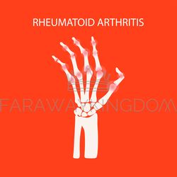 ARTHRITIS HAND Rheumatoid Medicine Education Vector Scheme