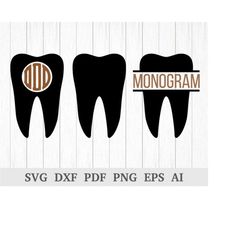 Tooth SVG, Tooth Monogram SVG, Dentist svg cutting files, Dental SVG, Teeth Svg, cricut & silhouette, screen, dxf, ai, p