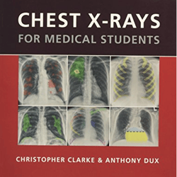 Chest X-rays for Medical Students 1st Edition