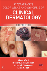 Complete Fitzpatrick's Color Atlas And SYNOPSIS OF Clinical Dermatology, 8th Ed 8th Edition.pdf