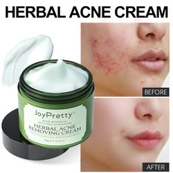 Scar Remove Oil control Against Acne Marks,Natural Herbal Acne Treatment Face Cream,Day Creams Skin Care JoyPretty