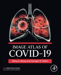 Image Atlas of COVID-19 1st Edition