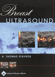 Breast Ultrasound 1st Edition