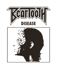 Beartooth Disease