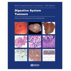 Digestive System Tumours: WHO Classification of Tumours (Medicine) 5th Edition