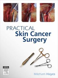 practical skin cancer surgery 1 pdf instant download