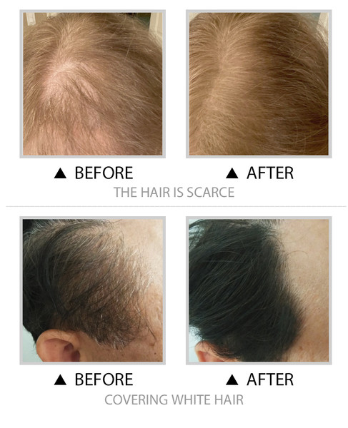 Sevich 12g Hair Line powder compact Waterproof Dark Brown Hair shad (27).jpg