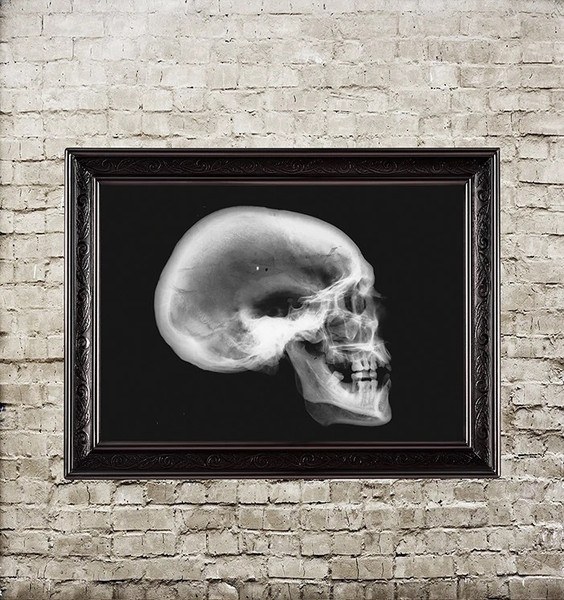 x-ray-of-a-human-skull.jpg