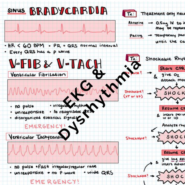 EKG Interpretation 5.jpg