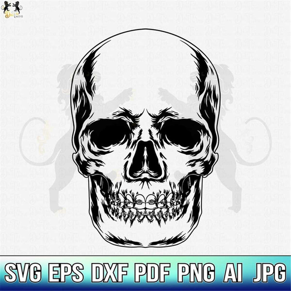 MR-2282023211140-skull-with-braces-svg-skull-svg-skull-clipart-skull-vector-image-1.jpg