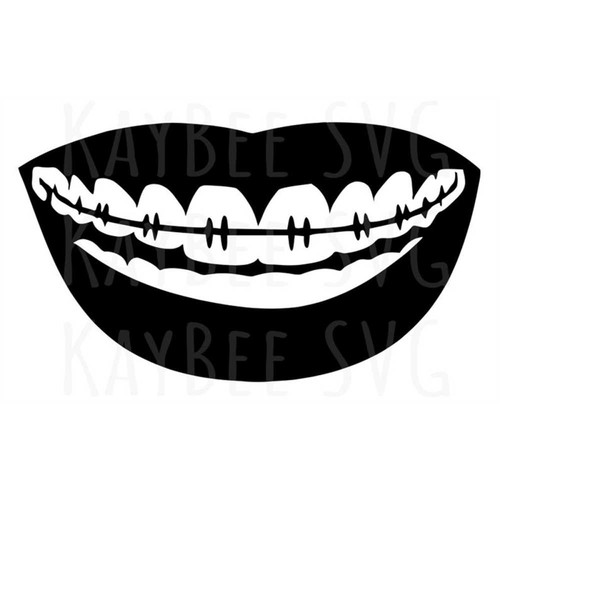 MR-1692023164452-orthodontic-braces-svg-png-jpg-clipart-digital-cut-file-image-1.jpg